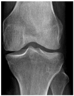 Diagnostics 14 00993 i004