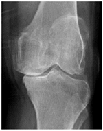 Diagnostics 14 00993 i005