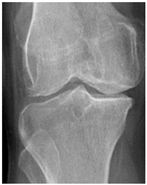 Diagnostics 14 00993 i006