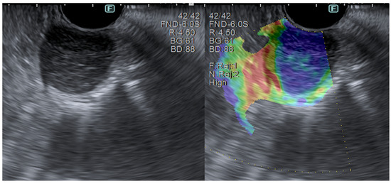 Diagnostics 14 00996 g007