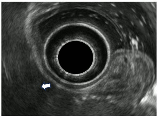 Diagnostics 14 00996 g008