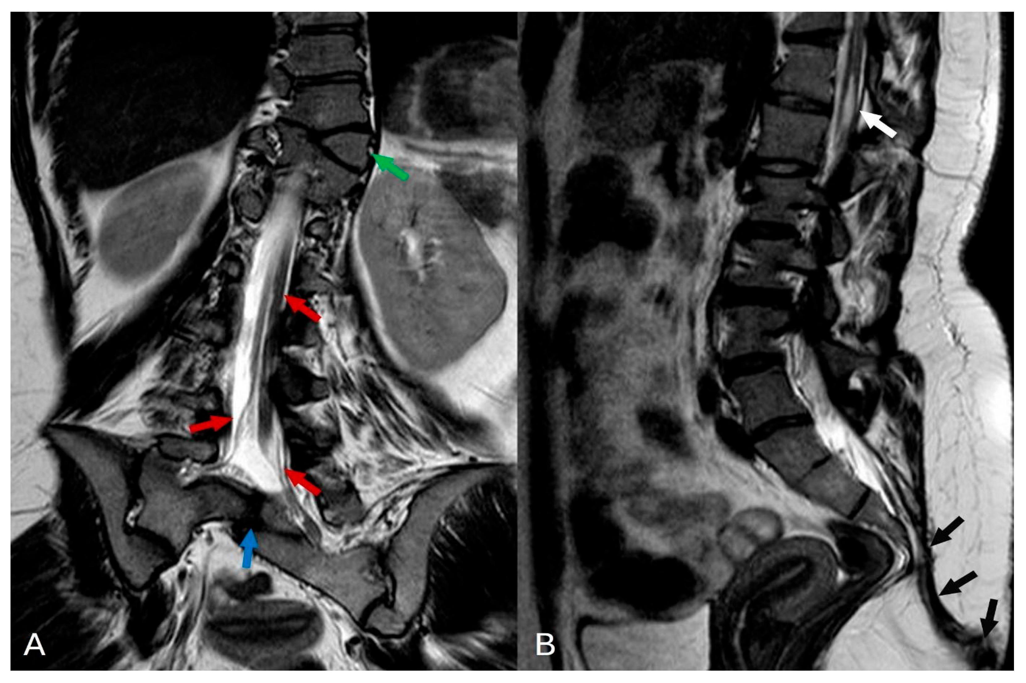 Diagnostics 14 01000 g003