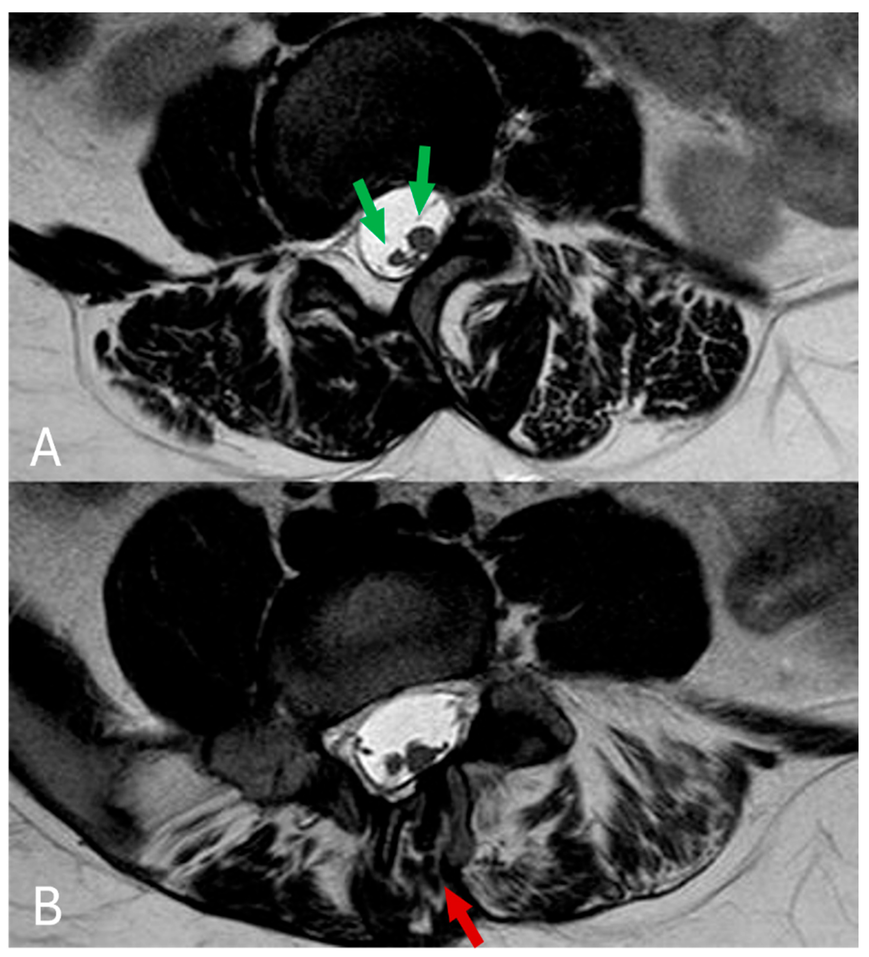 Diagnostics 14 01000 g004