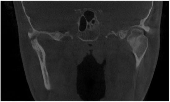 Diagnostics 14 01014 g001