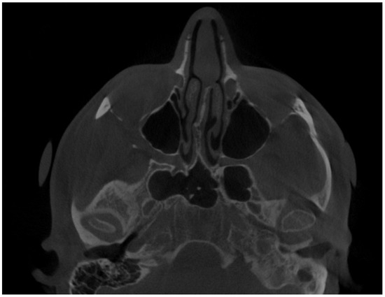 Diagnostics 14 01014 g002