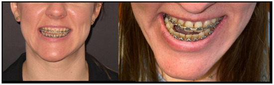 Diagnostics 14 01014 g003