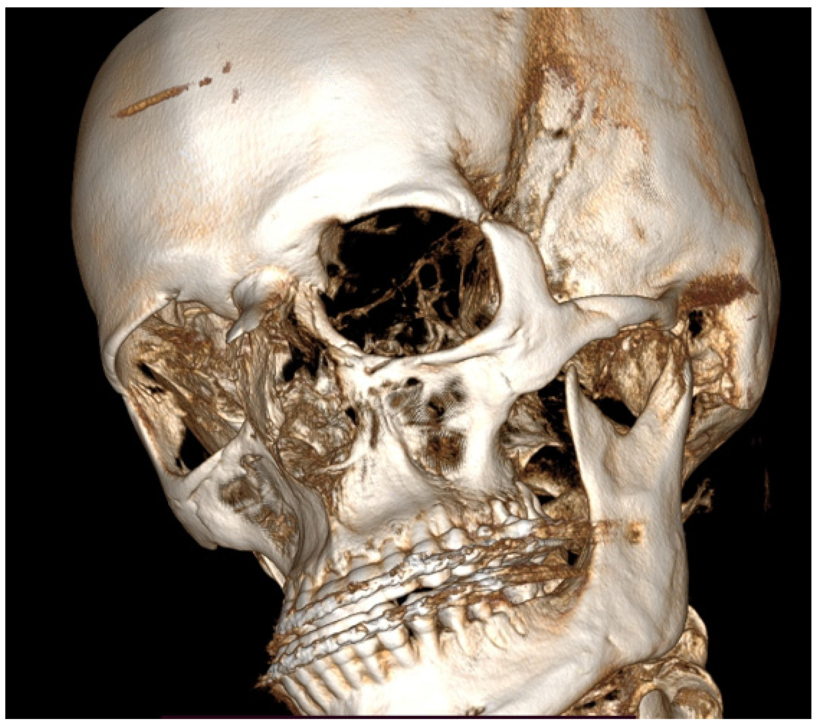 Diagnostics 14 01014 g005