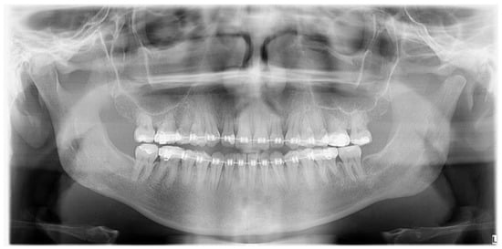 Diagnostics 14 01014 g006