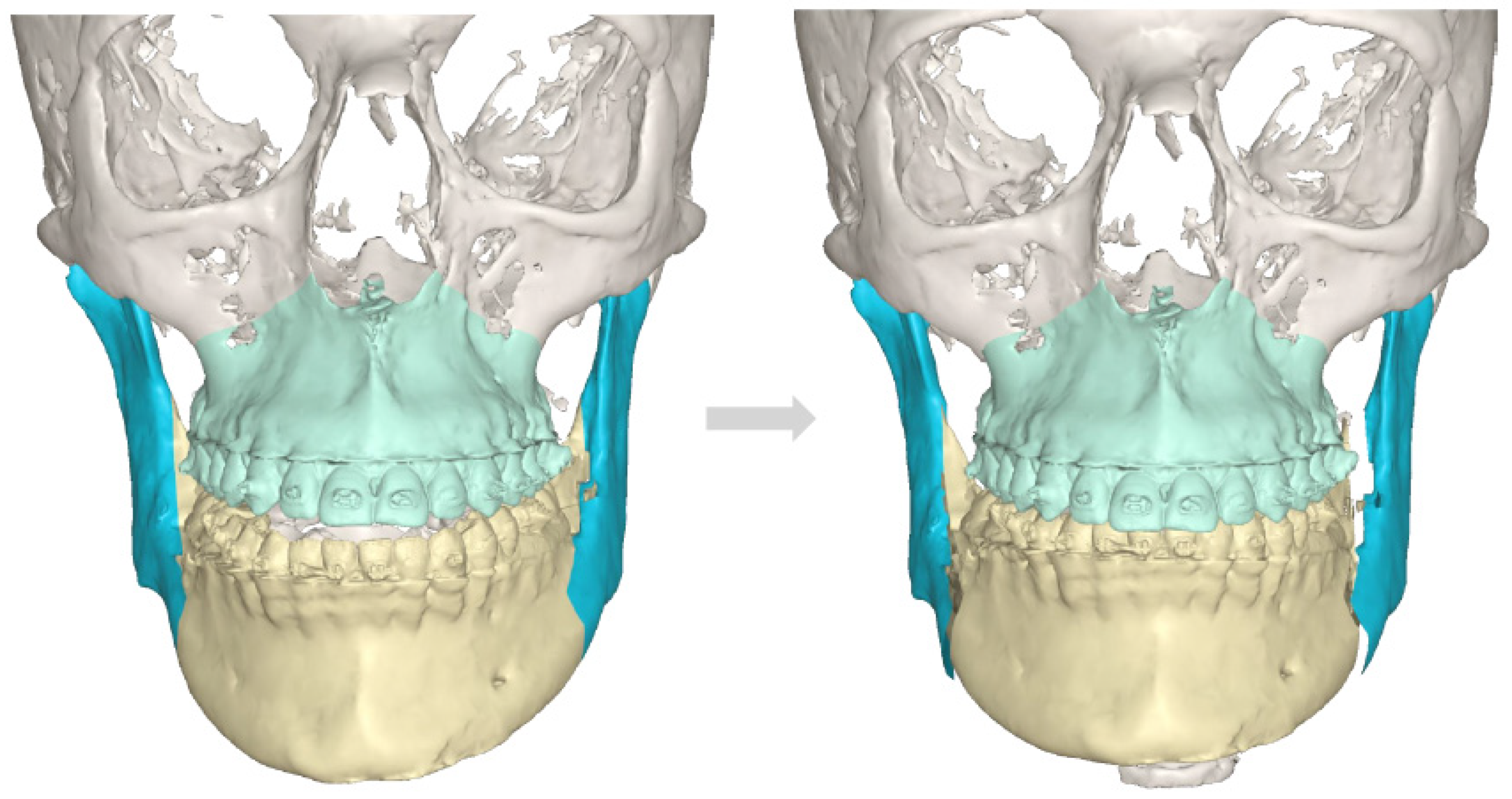 Diagnostics 14 01014 g007
