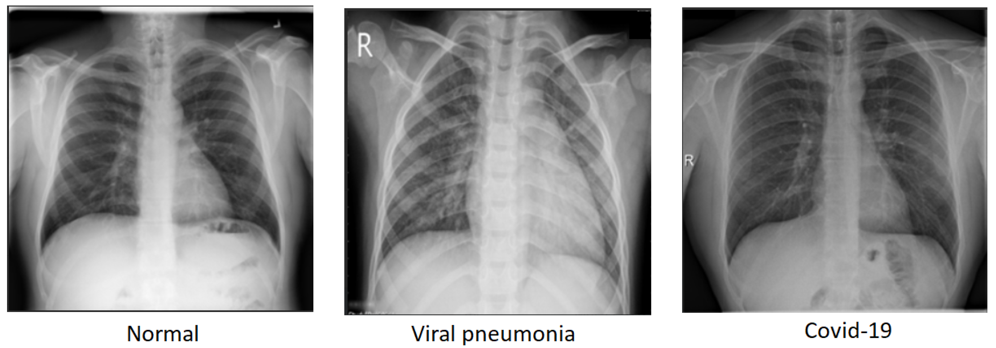 Diagnostics 14 01017 g001
