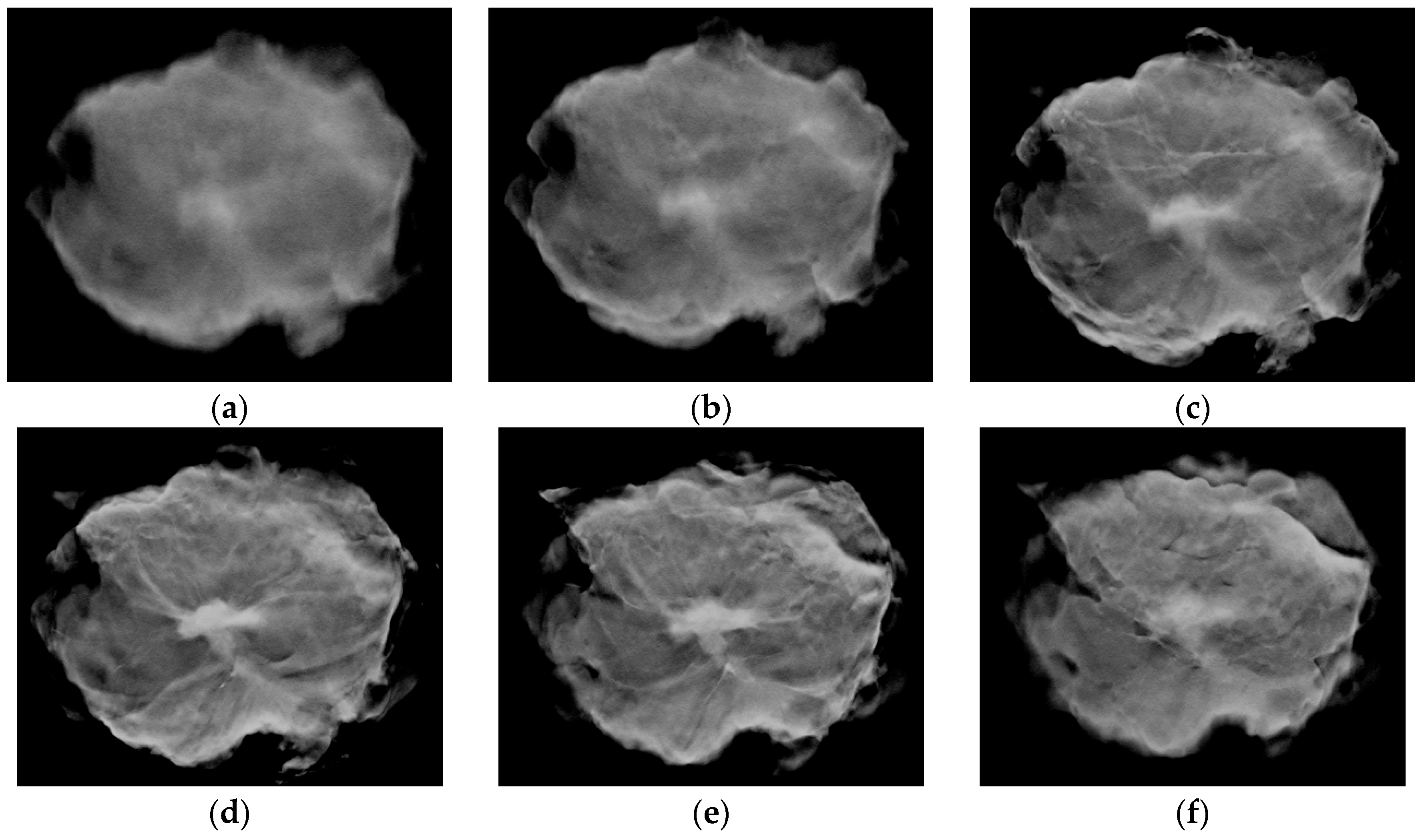 Diagnostics 14 01032 g002