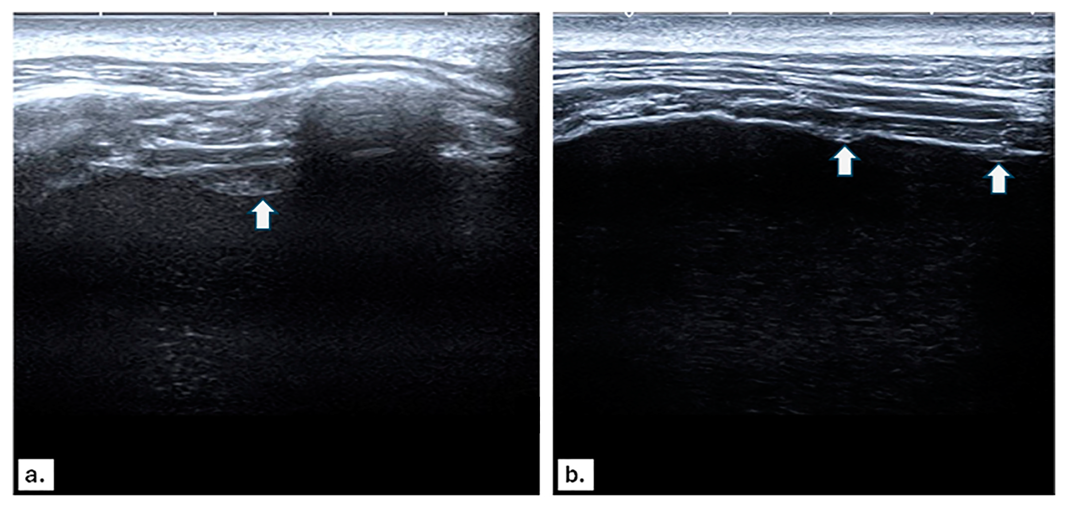 Diagnostics 14 01041 g001