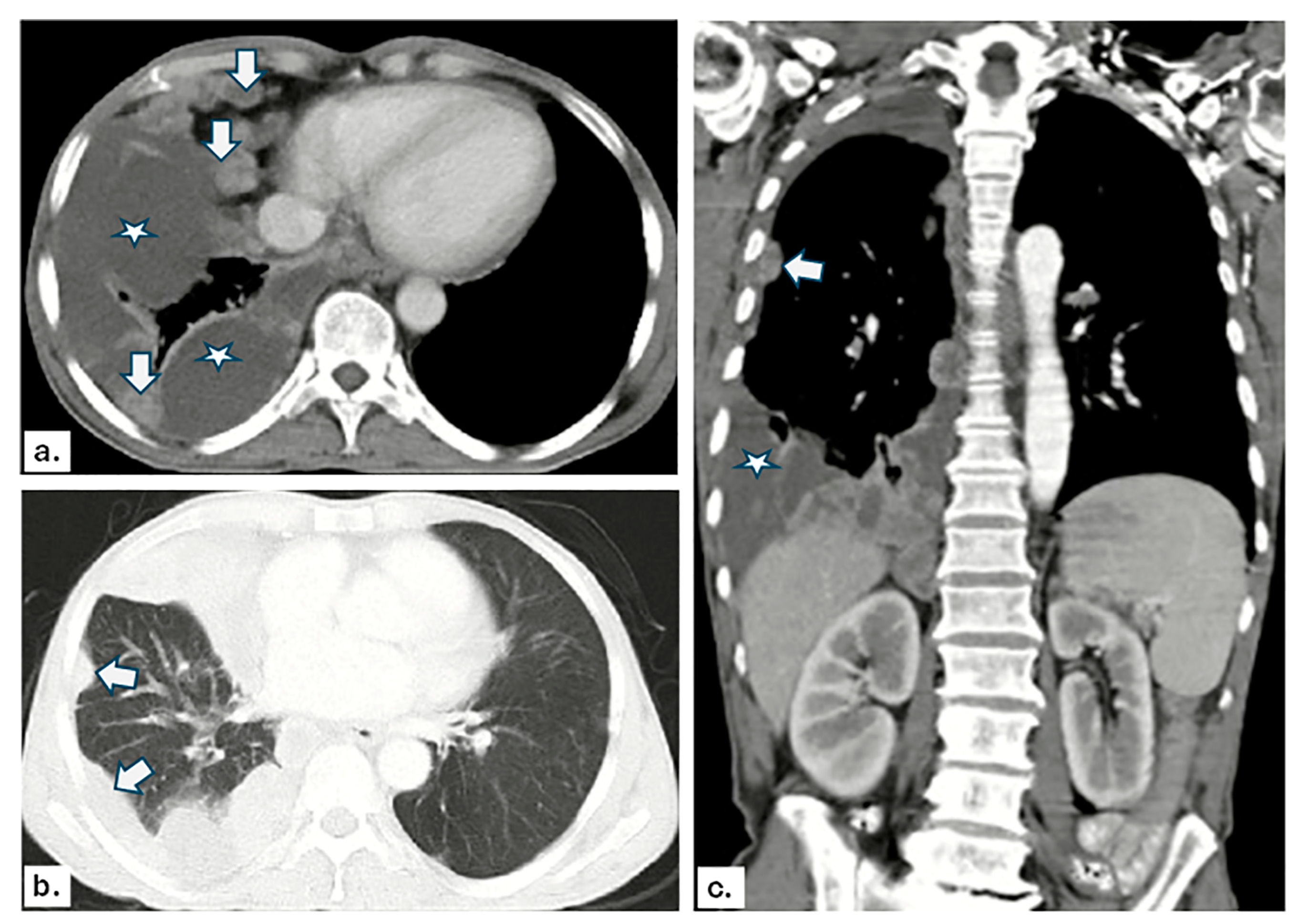 Diagnostics 14 01041 g002