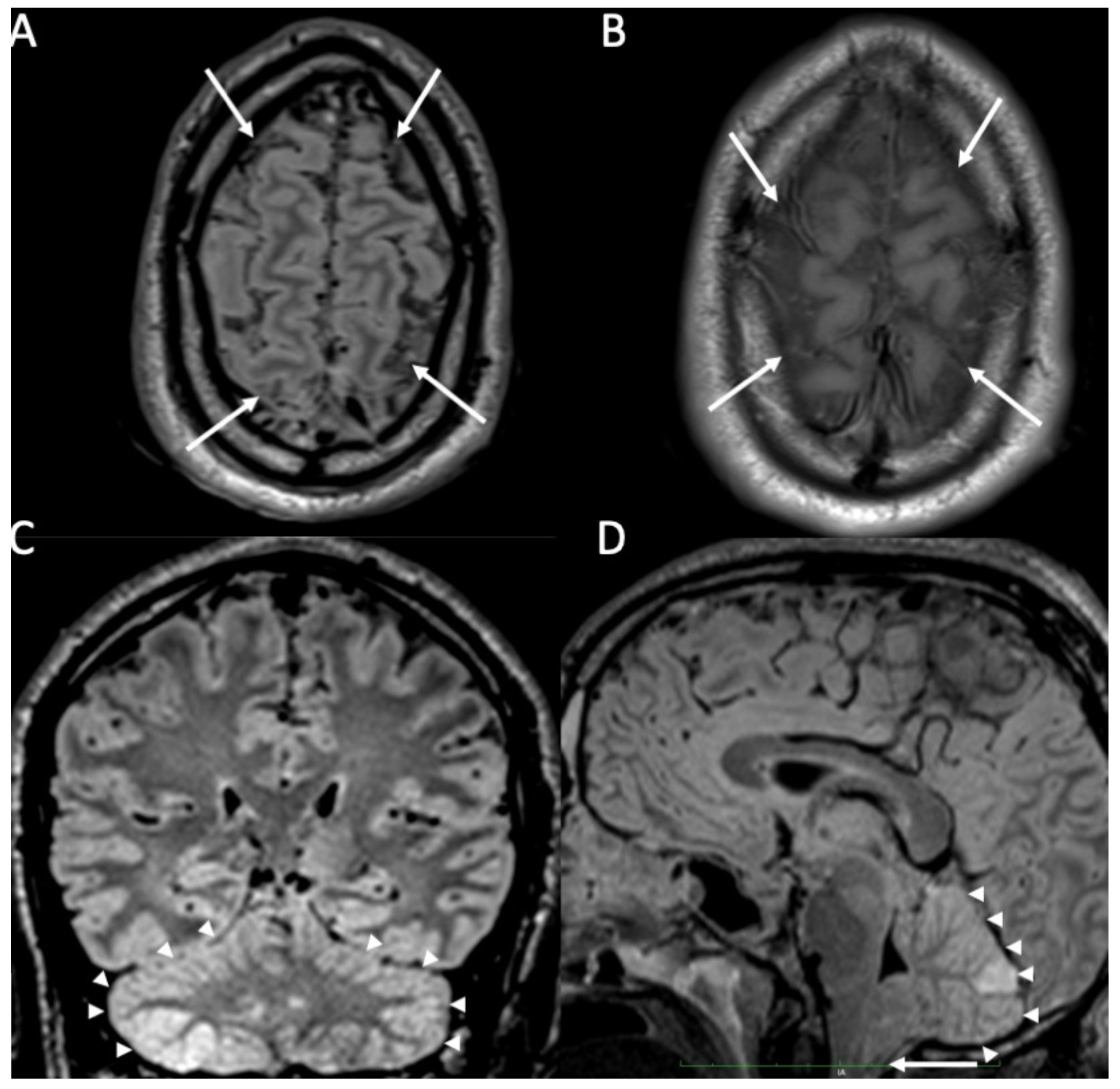 Diagnostics 14 01064 g001 Diagnostics 14 01064 g001