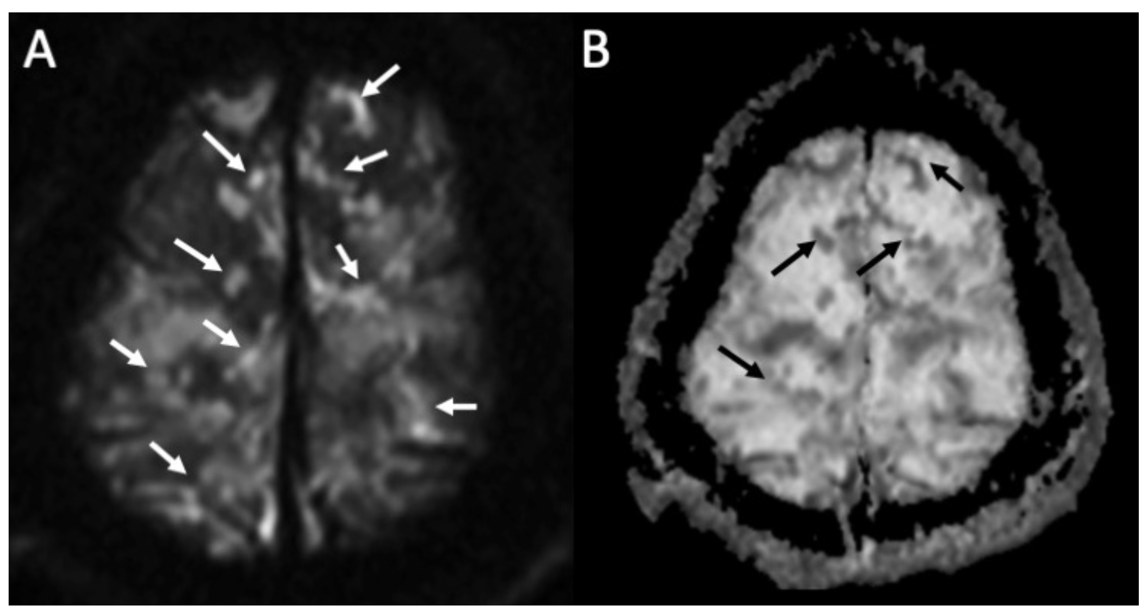 Diagnostics 14 01064 g002 Diagnostics 14 01064 g002