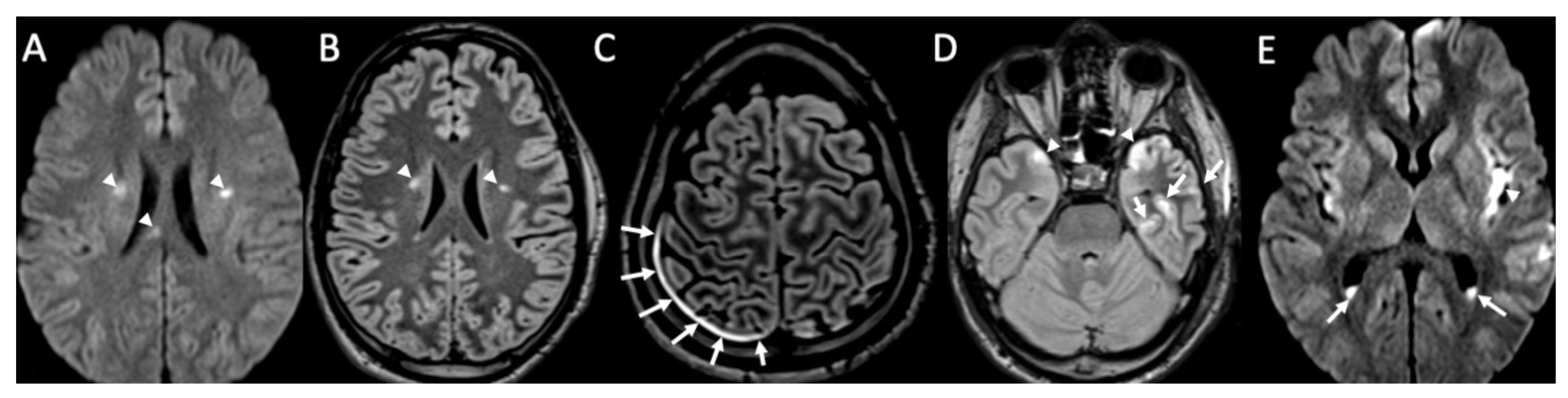 Diagnostics 14 01064 g003 Diagnostics 14 01064 g003