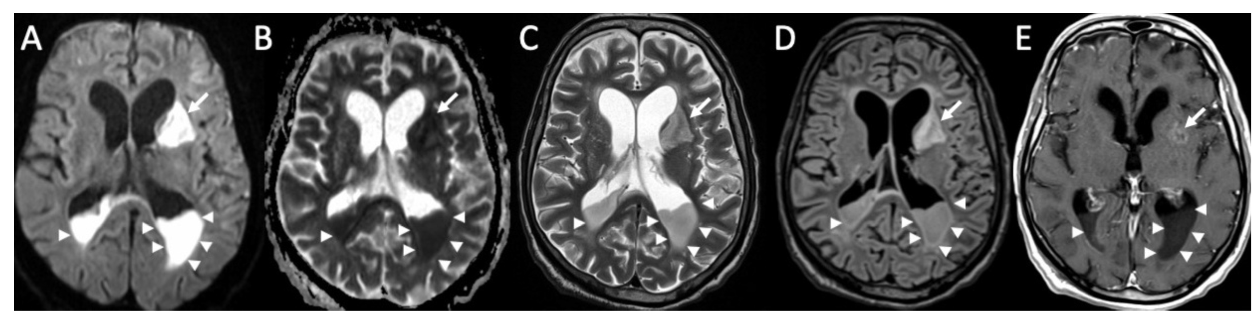 Diagnostics 14 01064 g005 Diagnostics 14 01064 g005