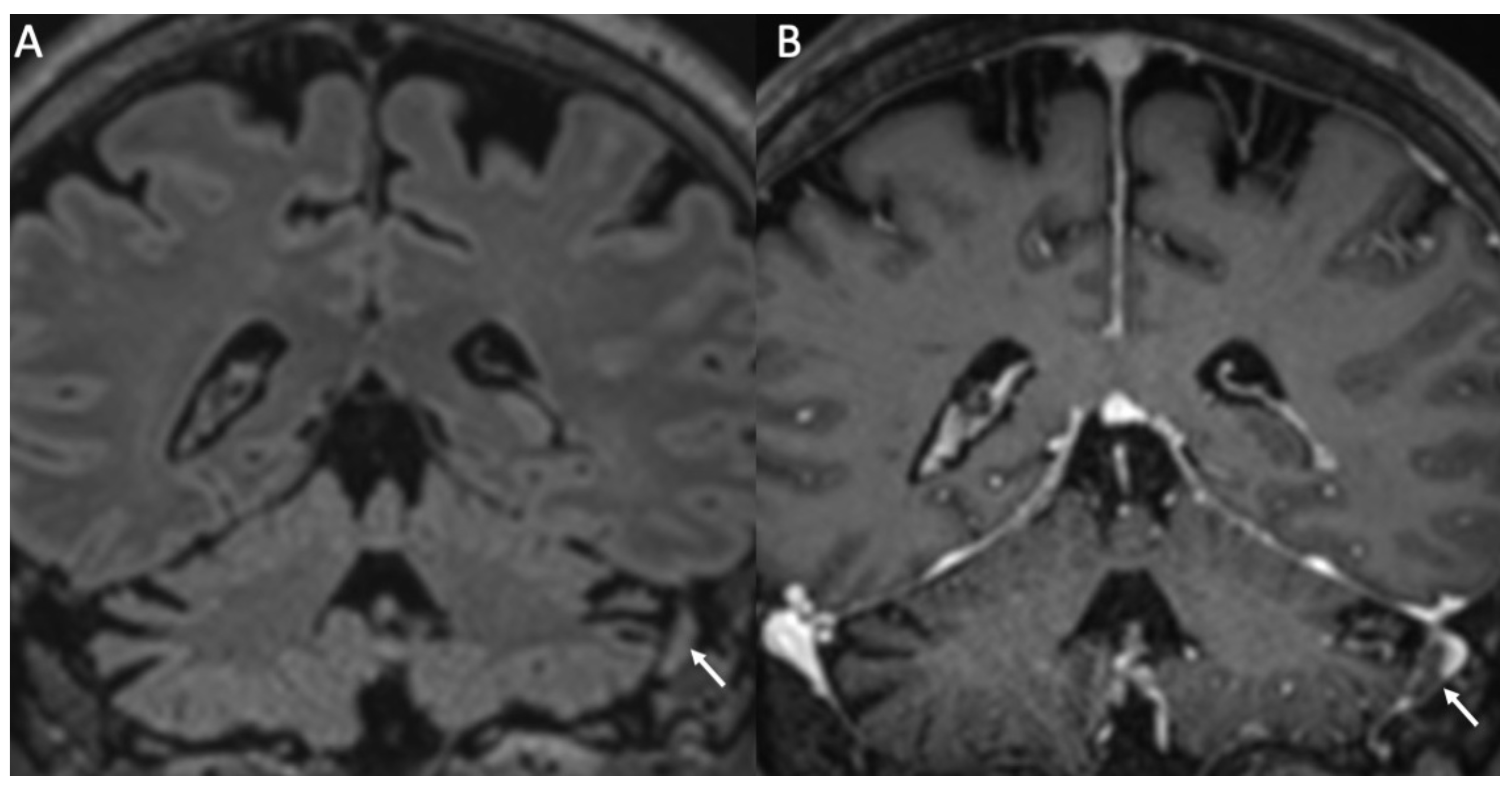 Diagnostics 14 01064 g007 Diagnostics 14 01064 g007