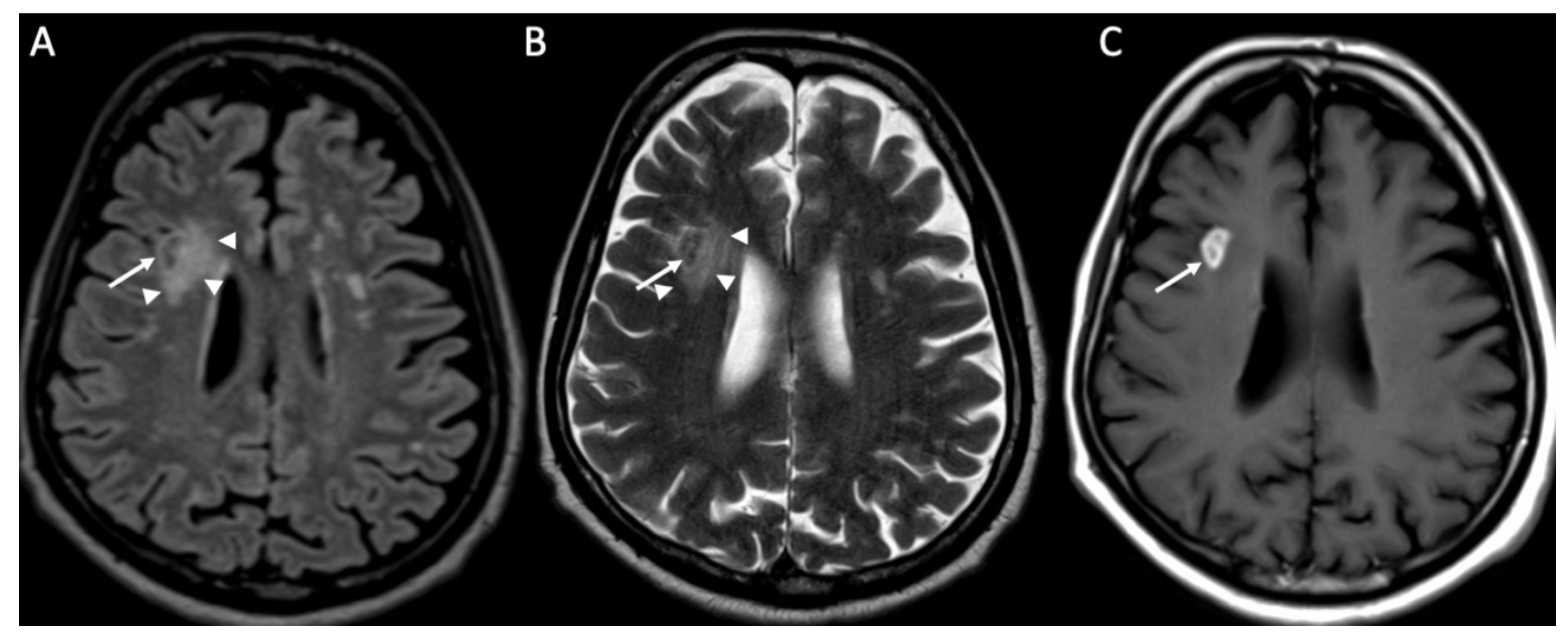 Diagnostics 14 01064 g009 Diagnostics 14 01064 g009