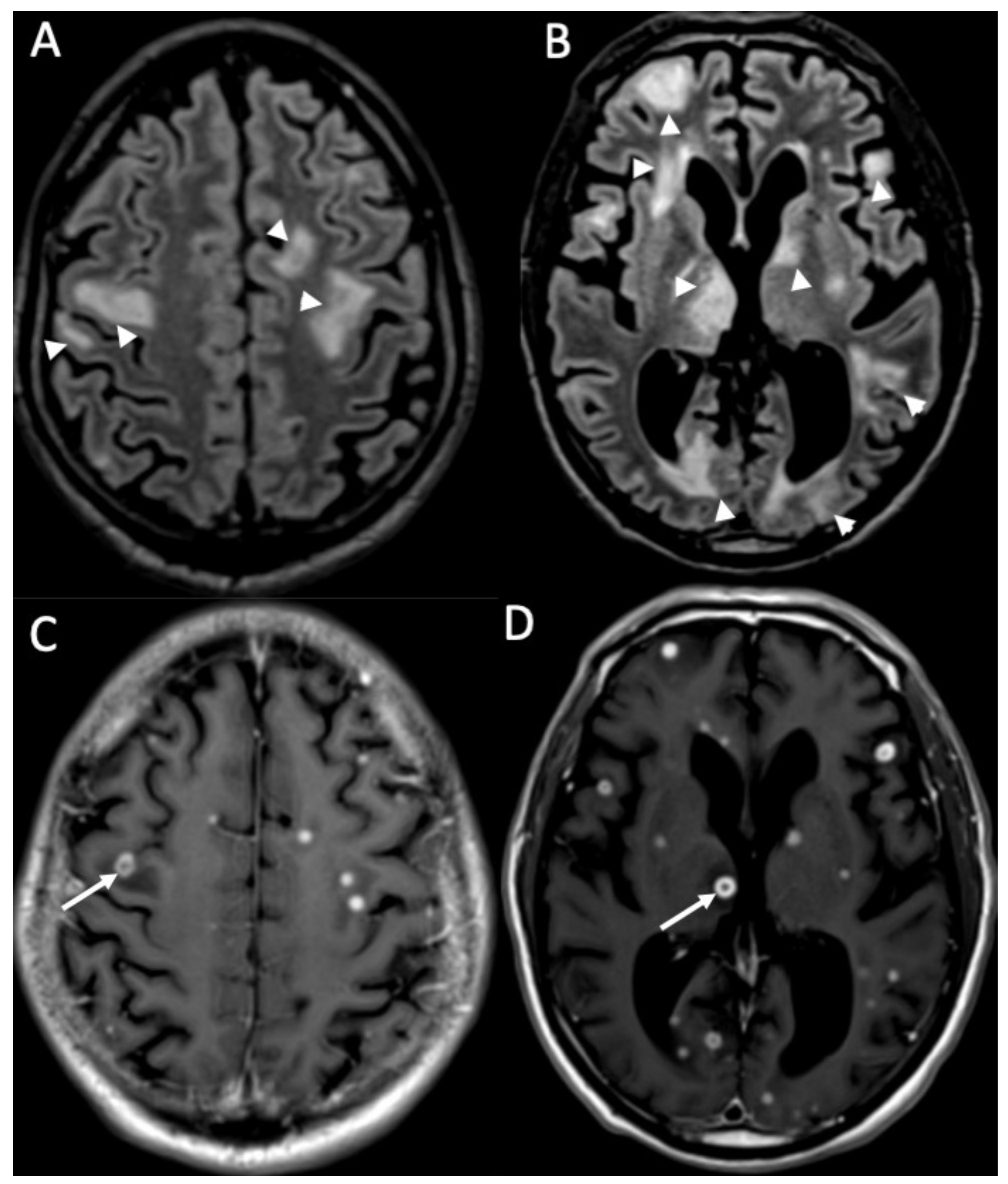 Diagnostics 14 01064 g010 Diagnostics 14 01064 g010