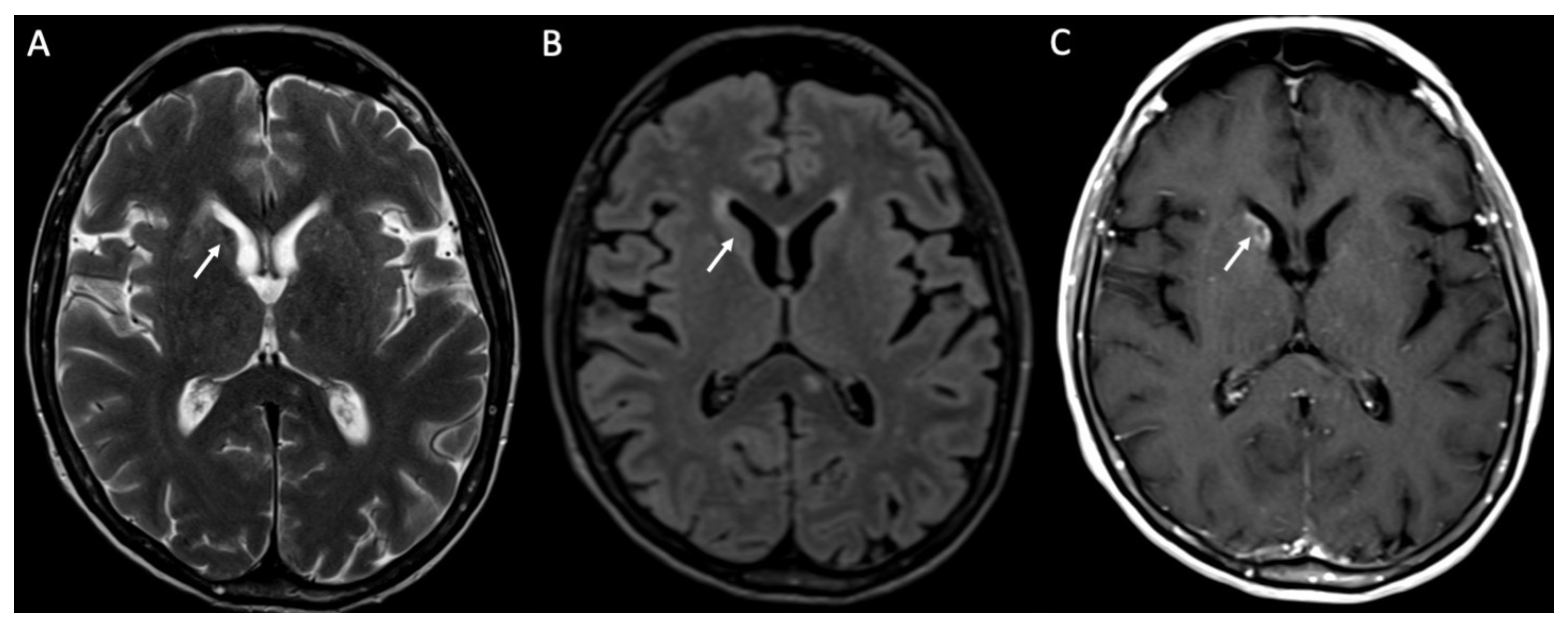 Diagnostics 14 01064 g011 Diagnostics 14 01064 g011