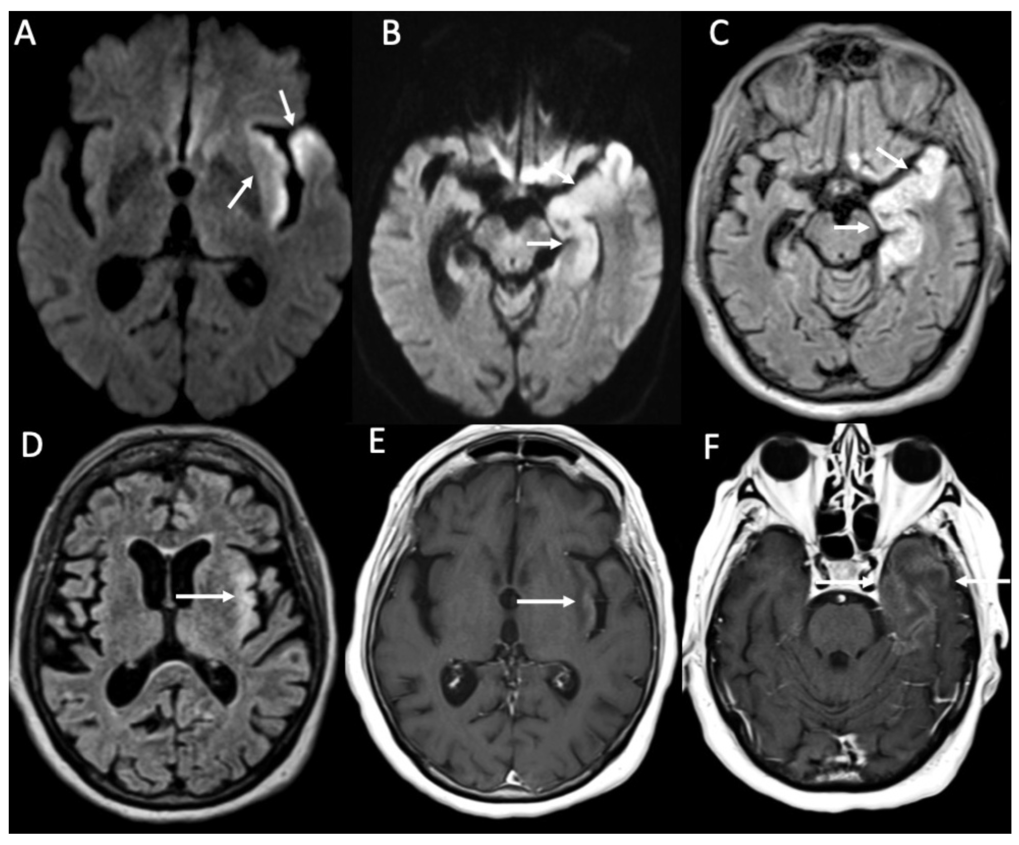 Diagnostics 14 01064 g013 Diagnostics 14 01064 g013