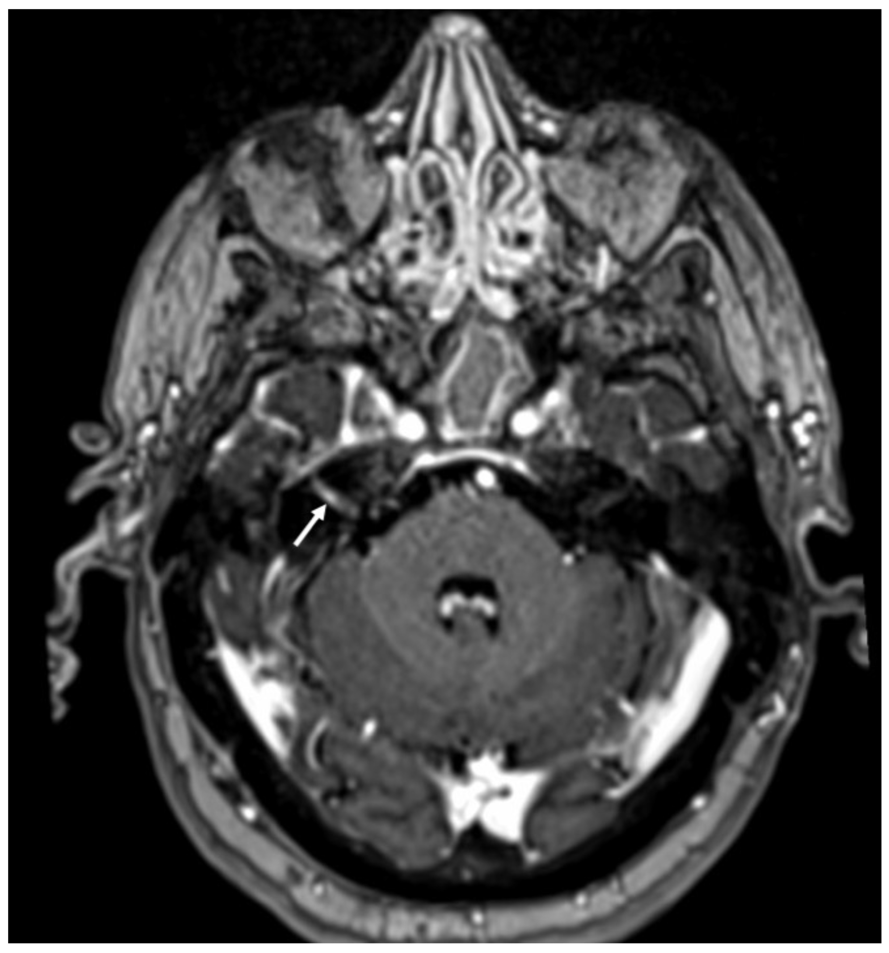 Diagnostics 14 01064 g015 Diagnostics 14 01064 g015