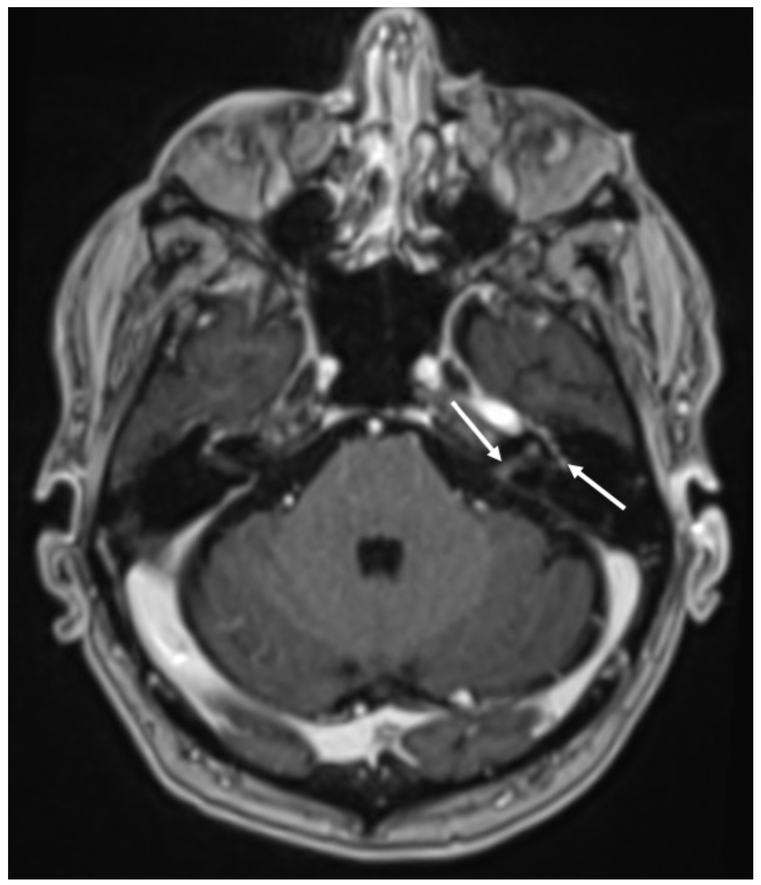 Diagnostics 14 01064 g016 Diagnostics 14 01064 g016