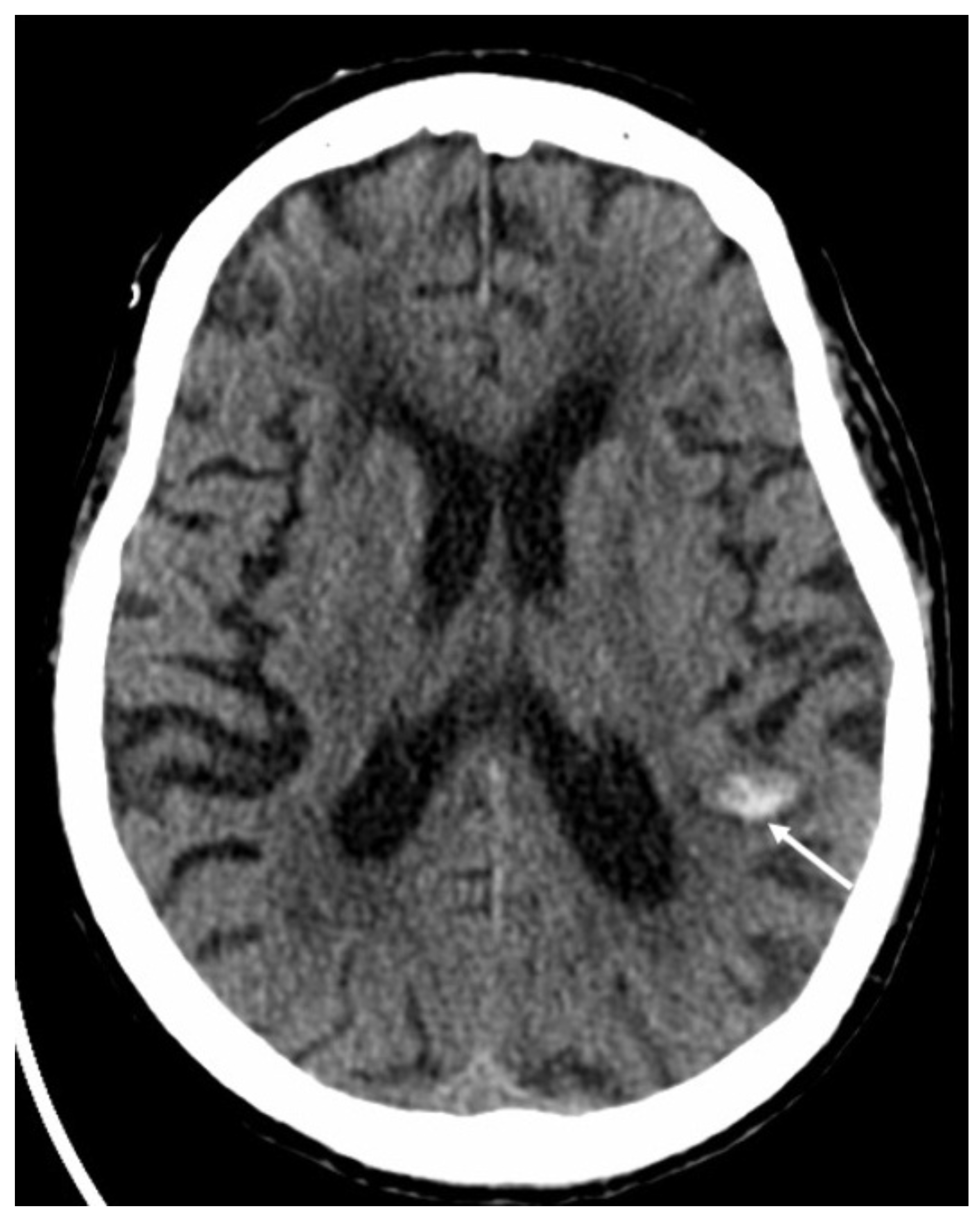 Diagnostics 14 01064 g017 Diagnostics 14 01064 g017