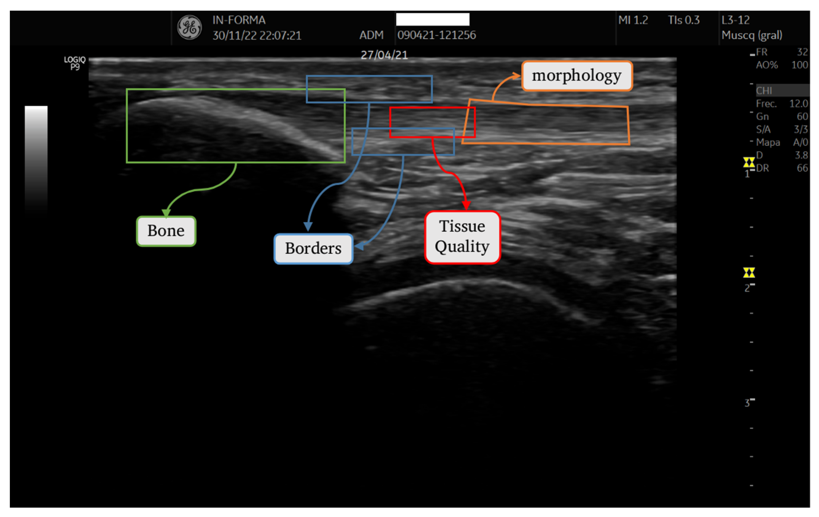 Diagnostics 14 01067 g002
