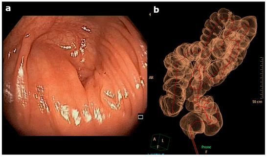Diagnostics 14 01072 g001