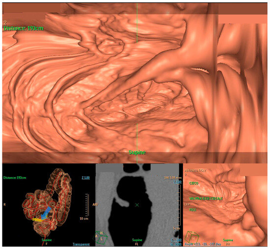Diagnostics 14 01072 g002