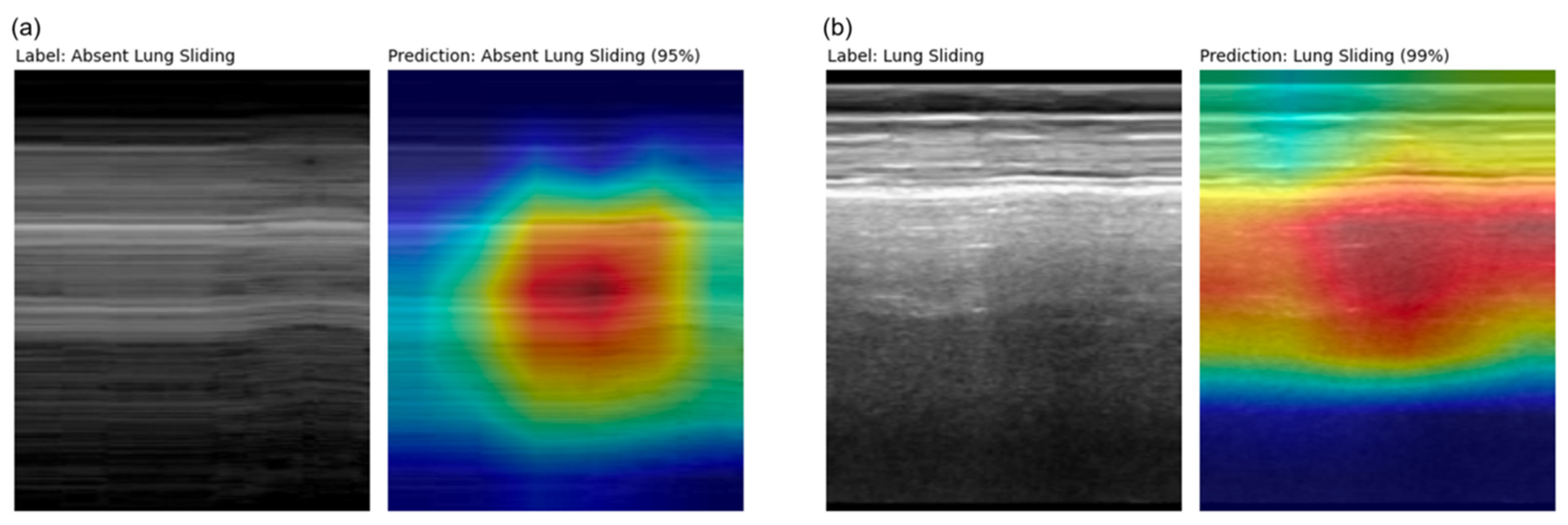 Diagnostics 14 01081 g006