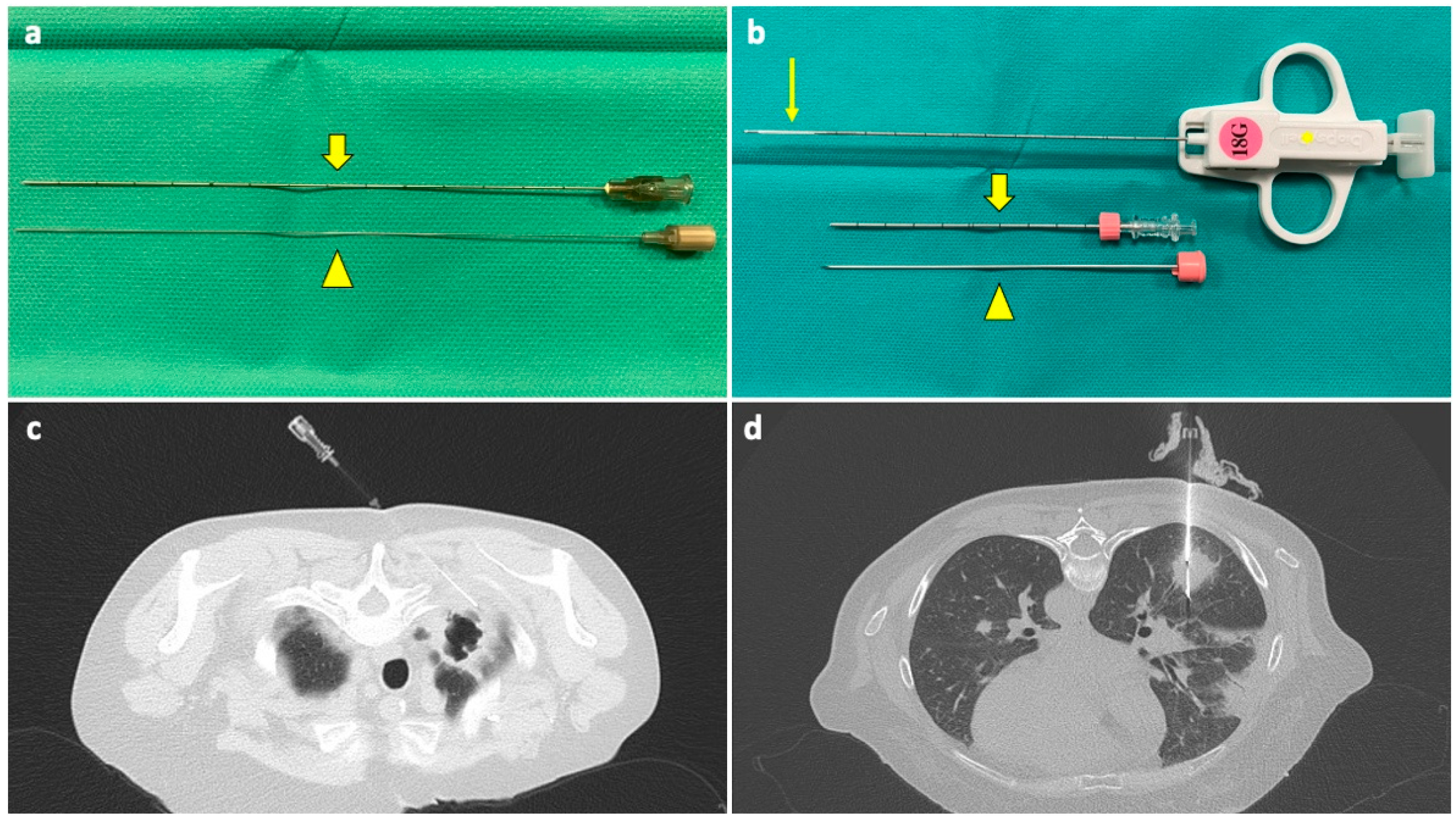 Diagnostics 14 01089 g001 Diagnostics 14 01089 g001