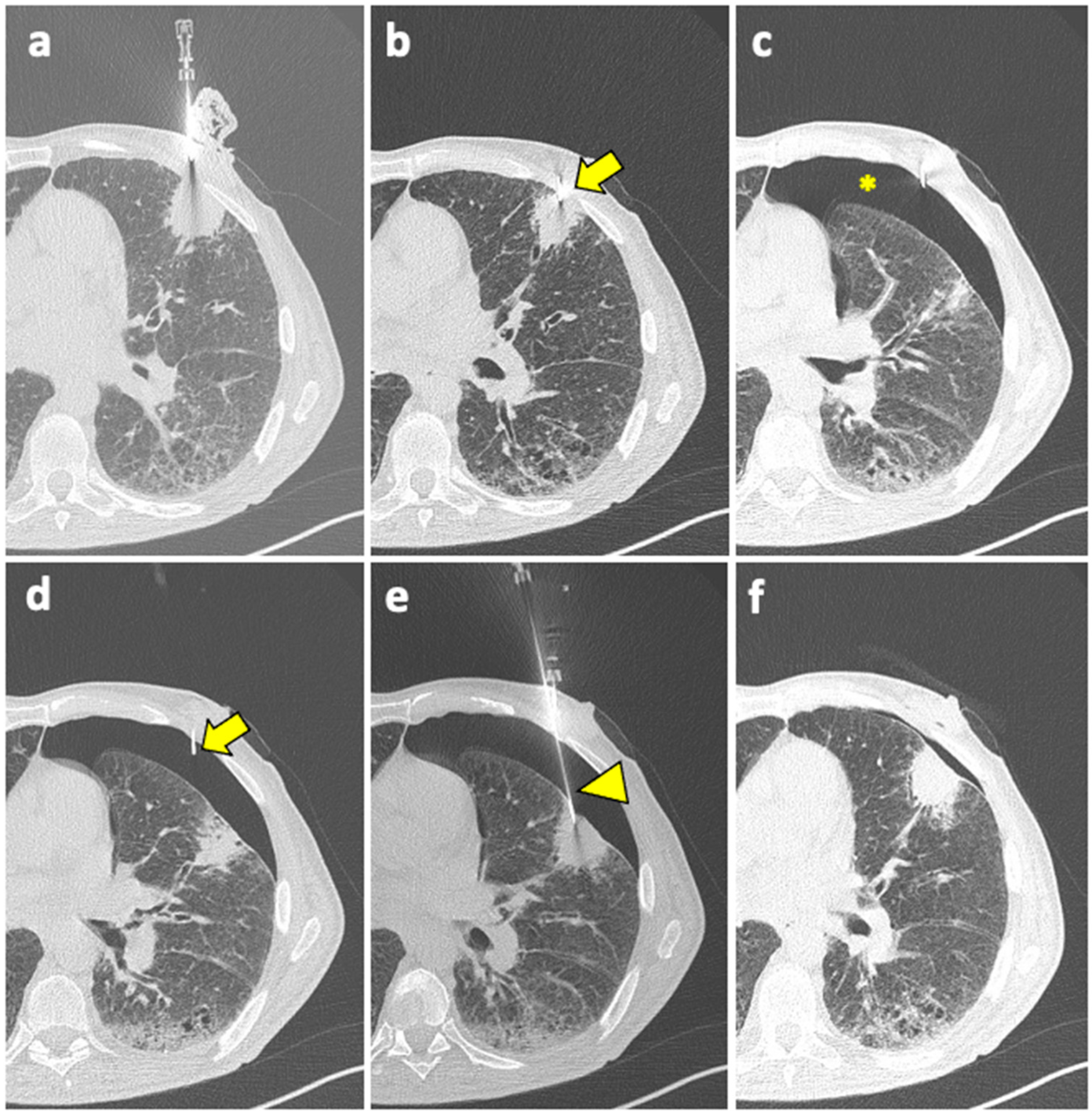 Diagnostics 14 01089 g002 Diagnostics 14 01089 g002