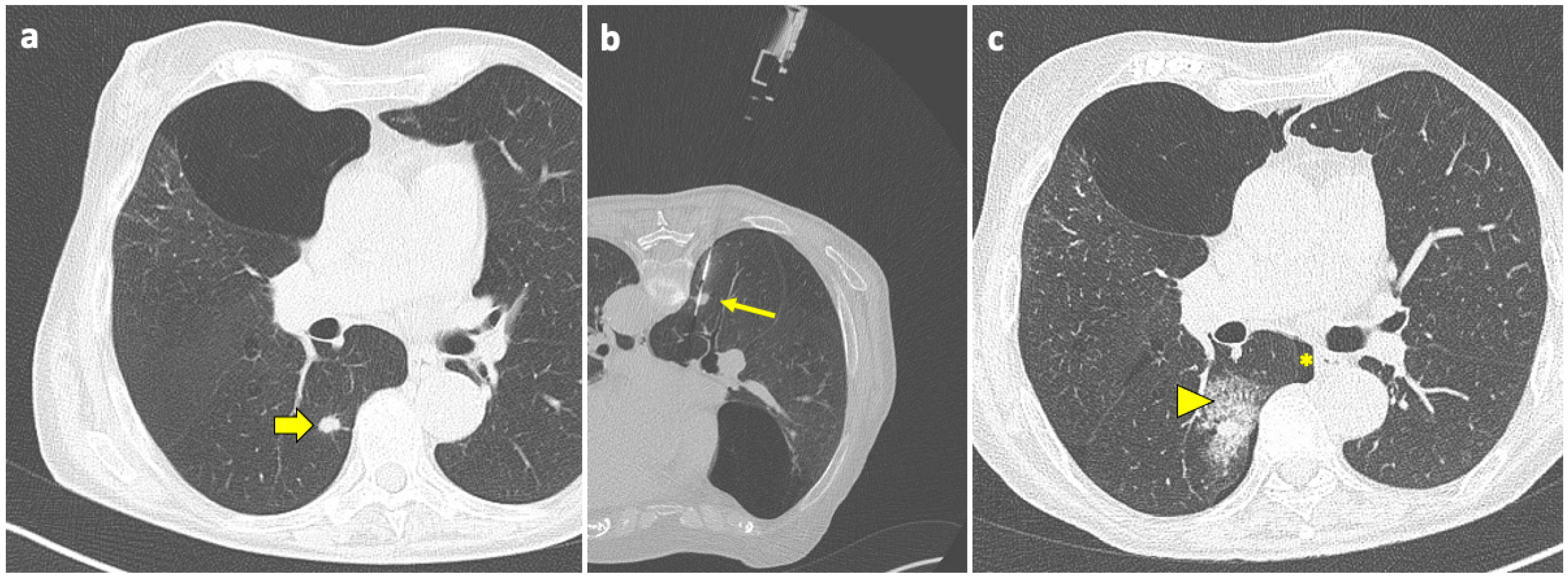 Diagnostics 14 01089 g003 Diagnostics 14 01089 g003