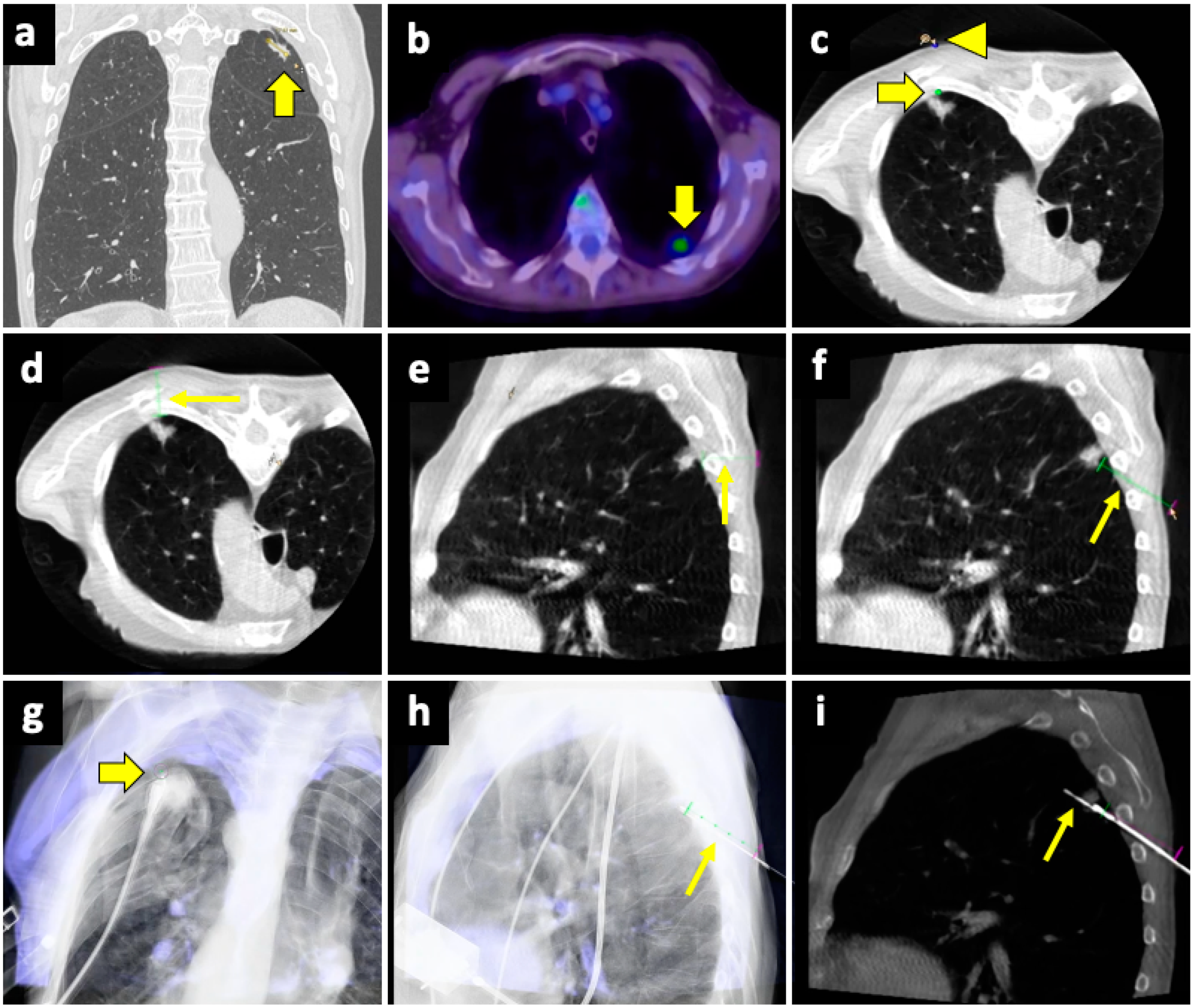 Diagnostics 14 01089 g004 Diagnostics 14 01089 g004