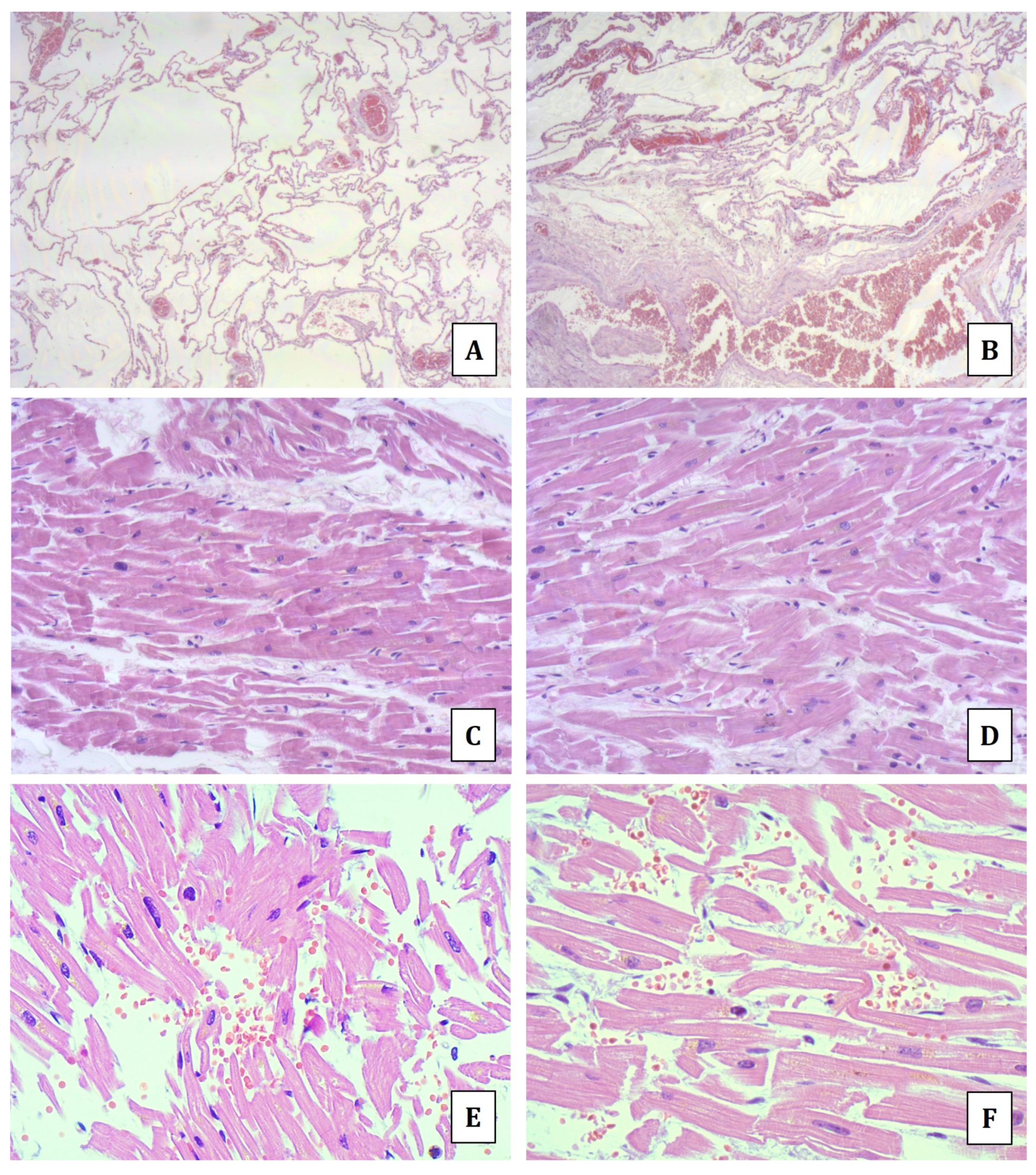 Diagnostics 14 01092 g001