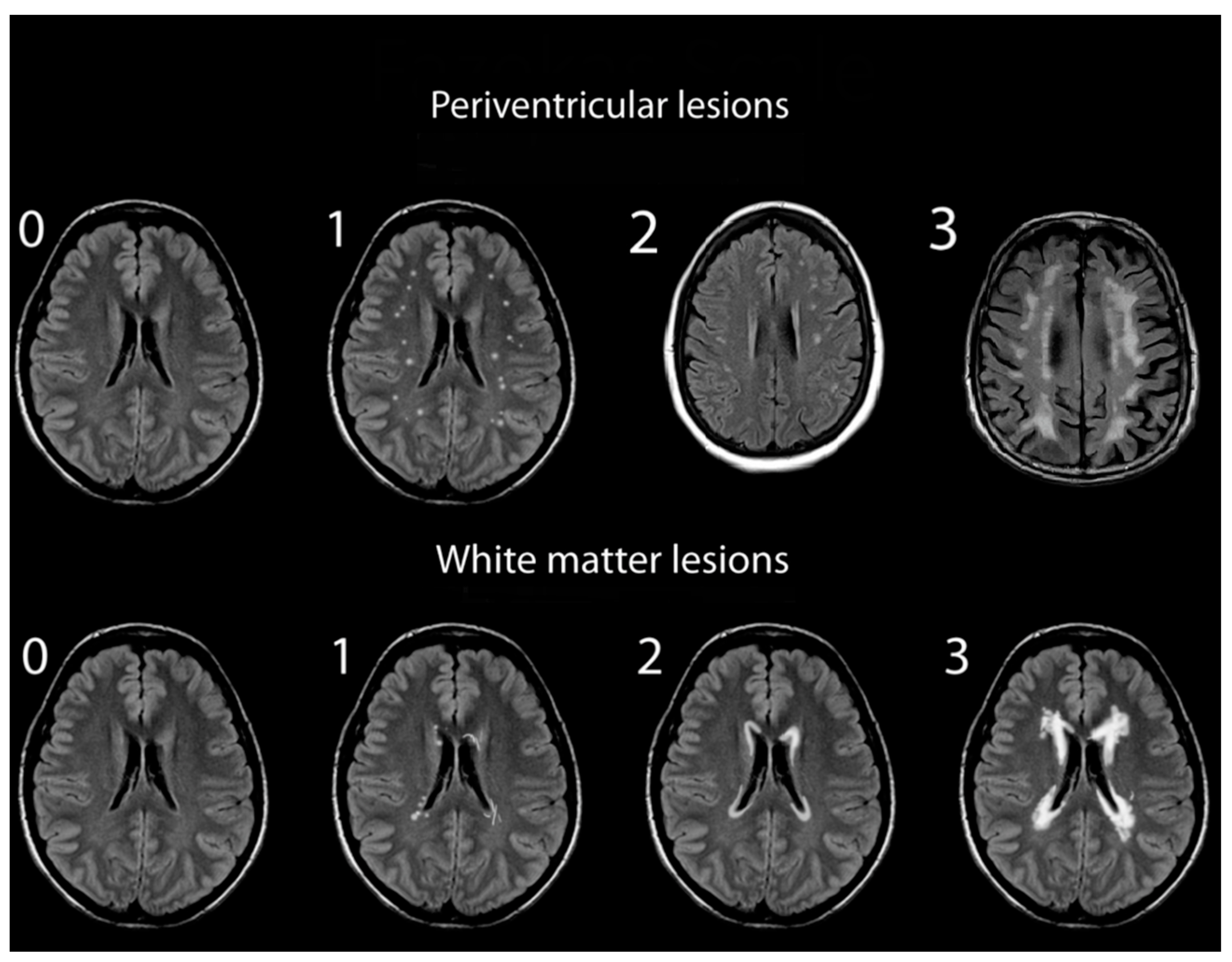 Diagnostics 14 01109 g001