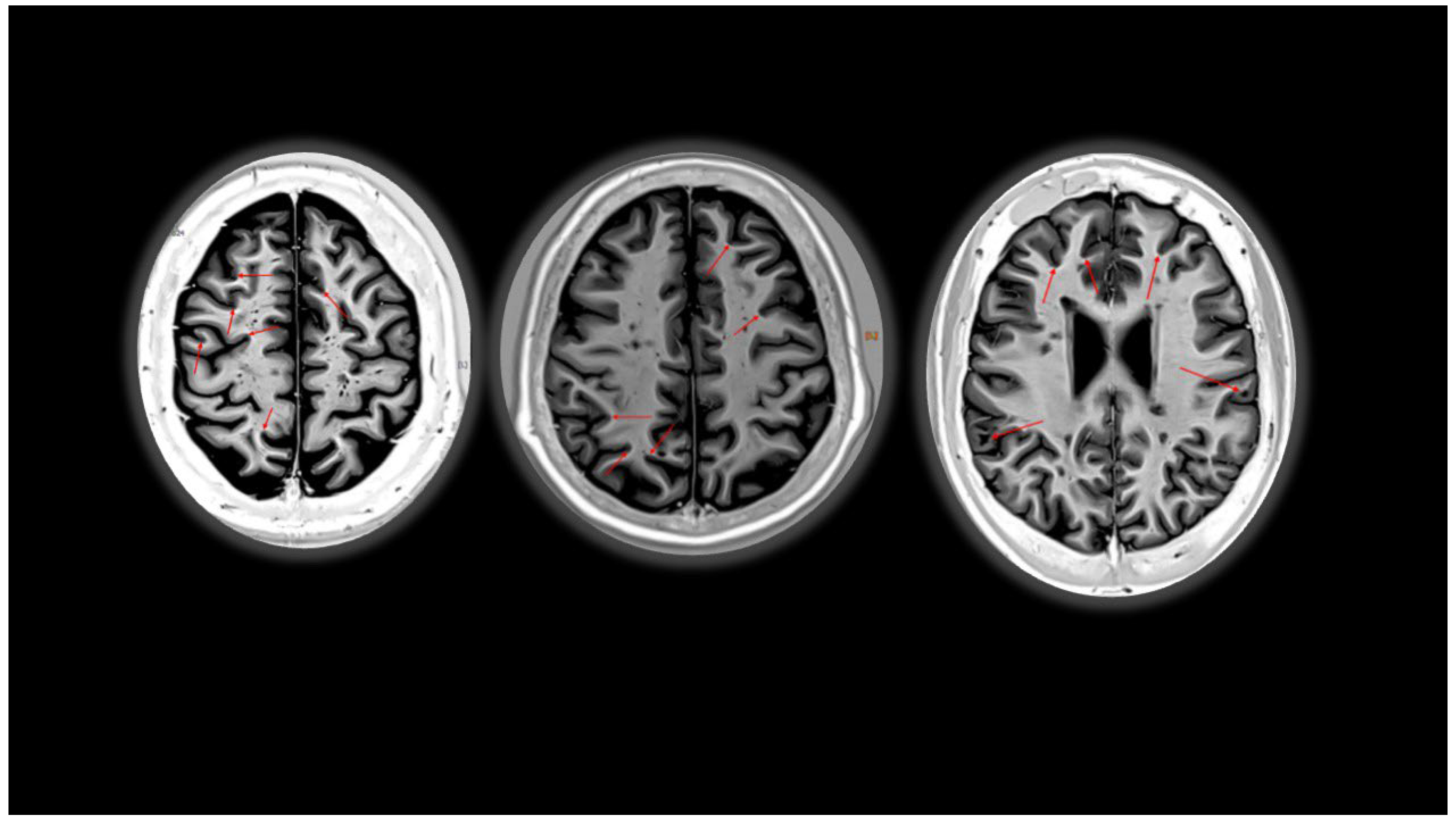 Diagnostics 14 01120 g002