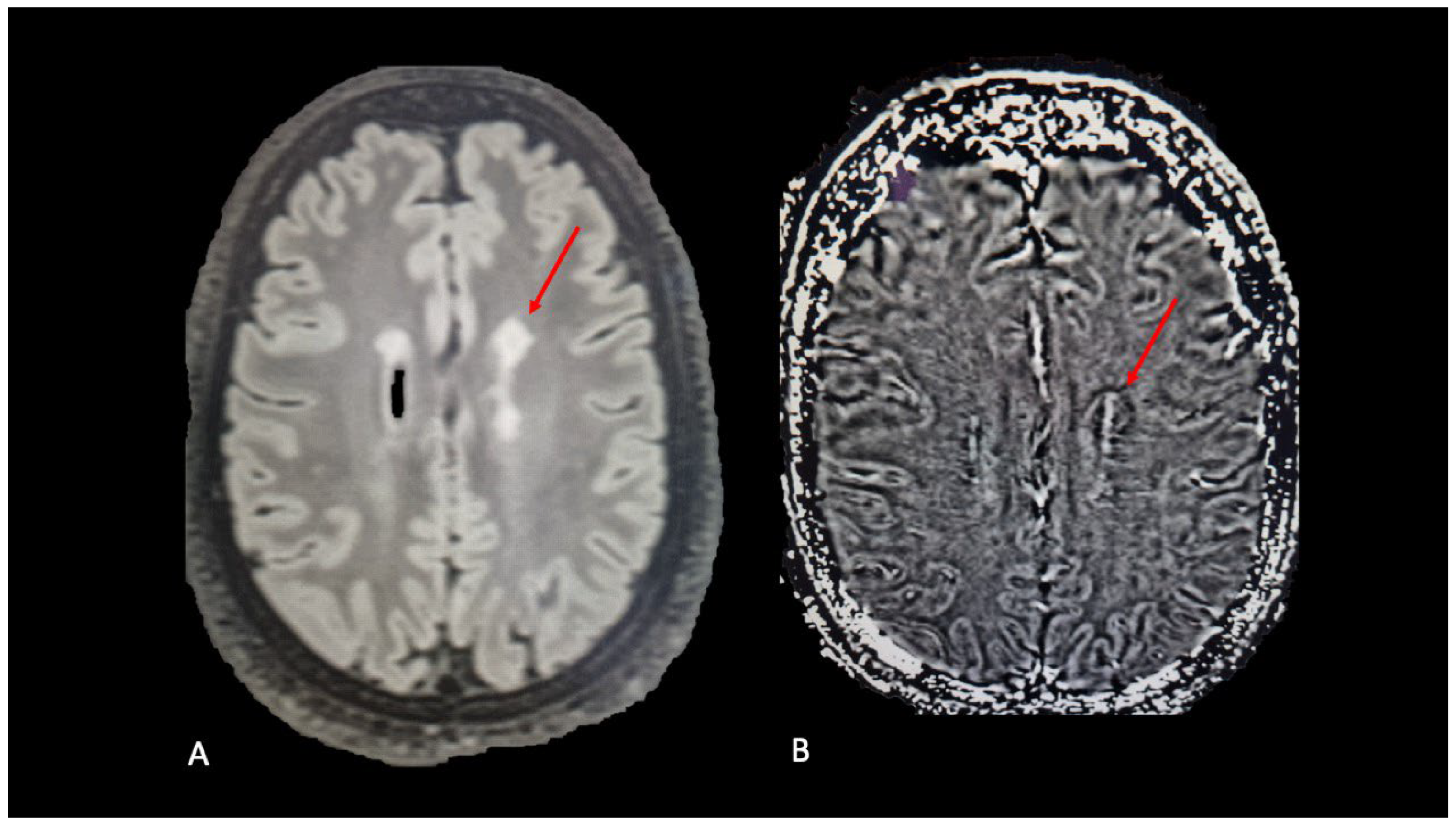 Diagnostics 14 01120 g003
