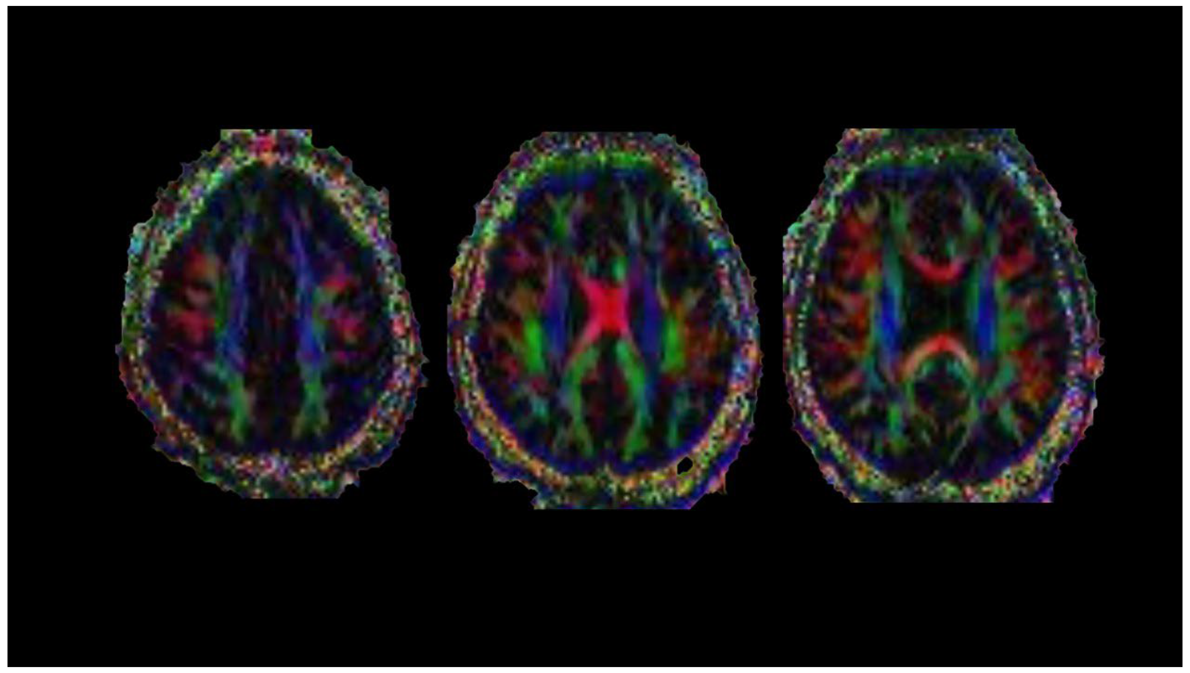 Diagnostics 14 01120 g004
