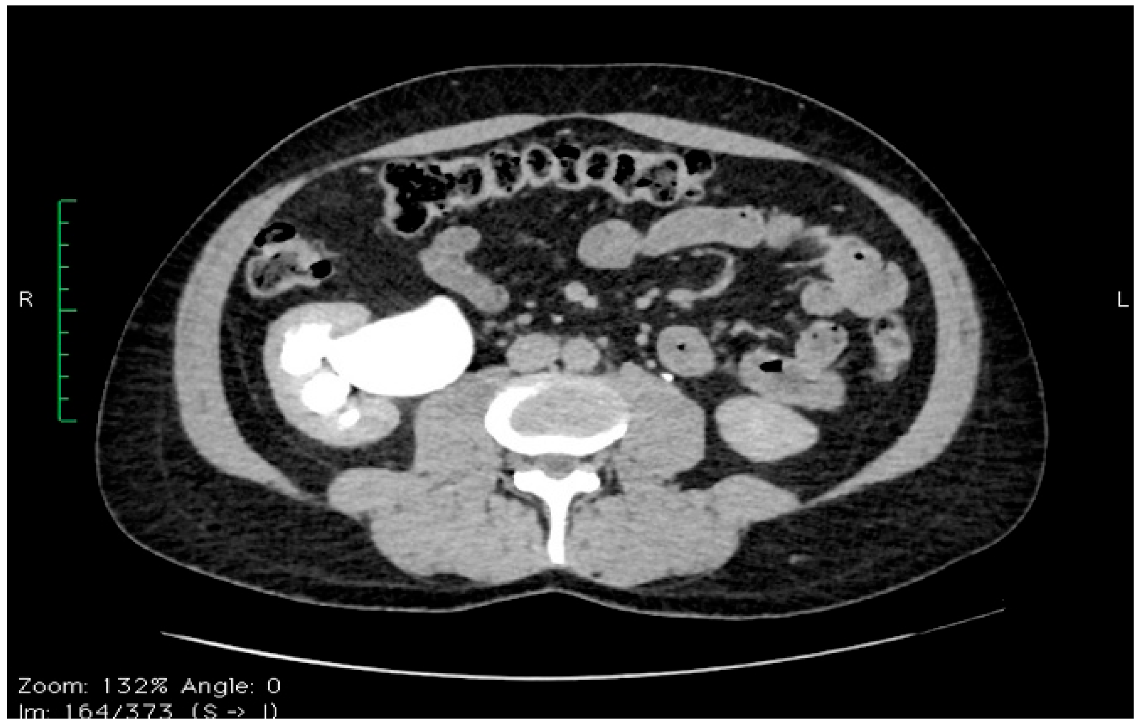 Diagnostics 14 01121 g001