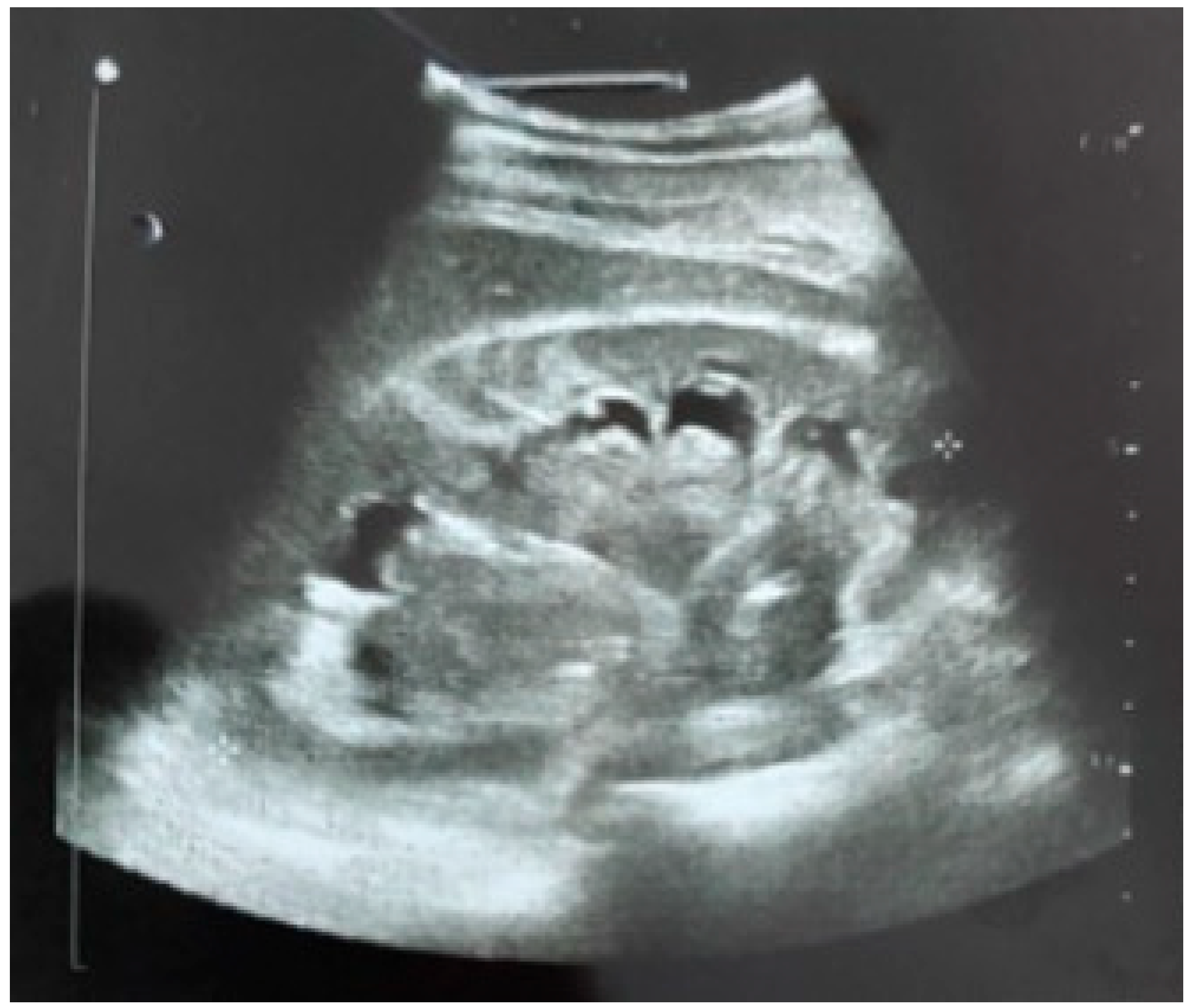 Diagnostics 14 01121 g002