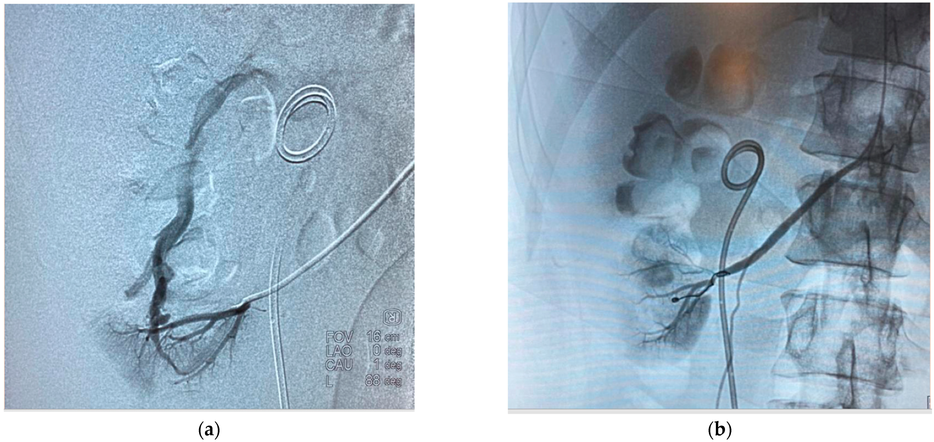 Diagnostics 14 01121 g003