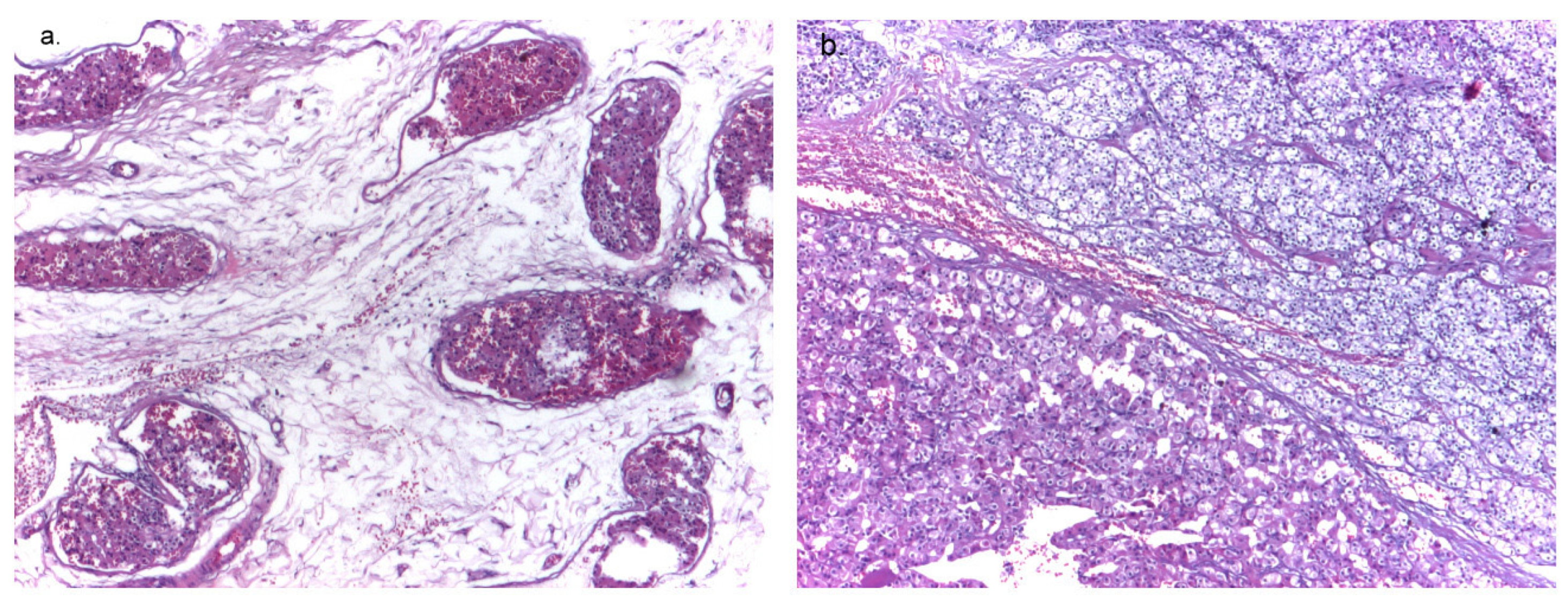 Diagnostics 14 01127 g002