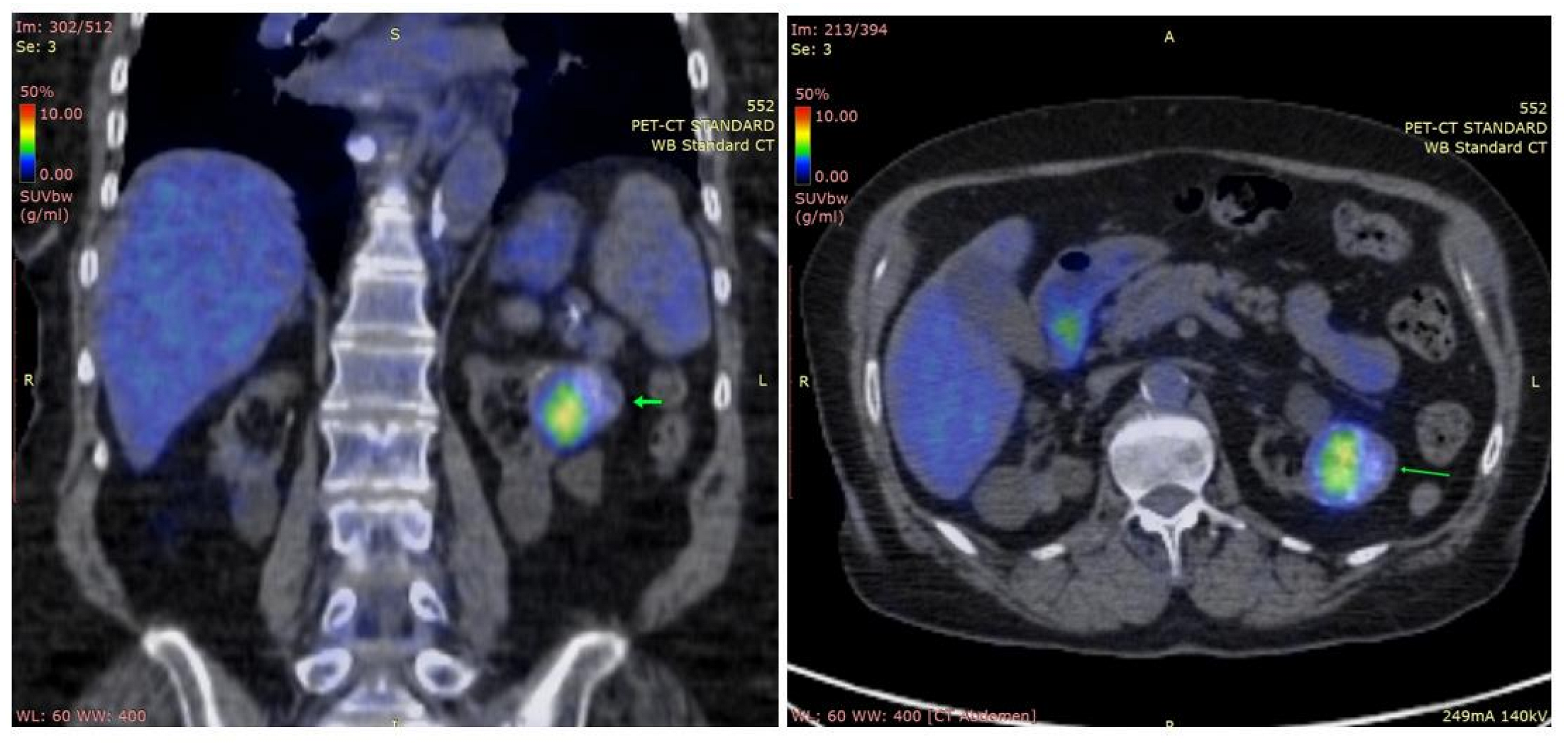 Diagnostics 14 01127 g003