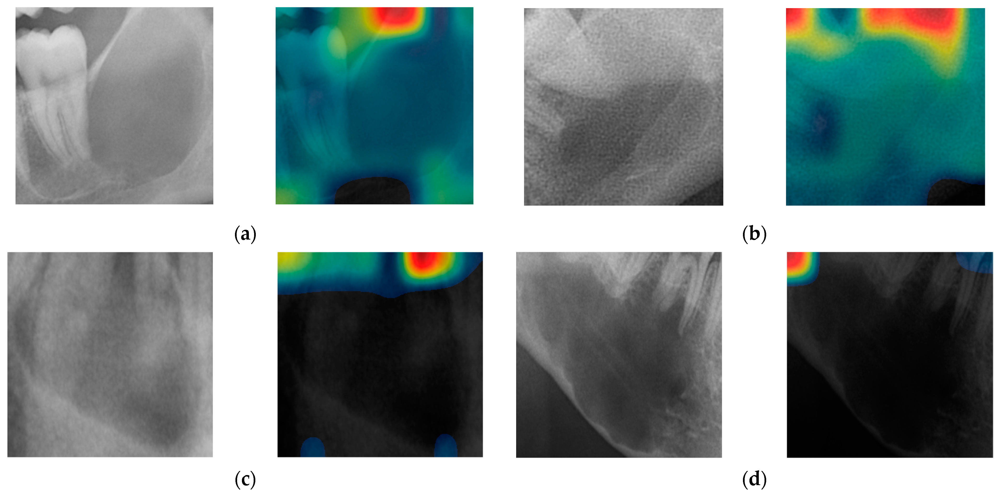 Diagnostics 14 01144 g004