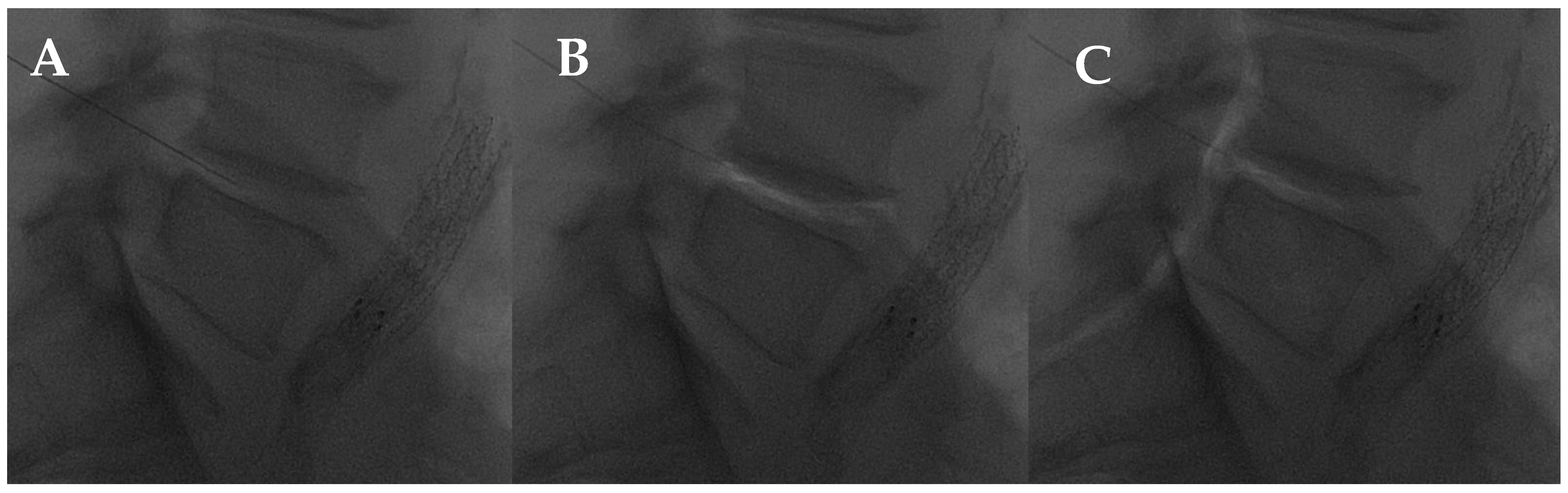 Diagnostics 14 01147 g008