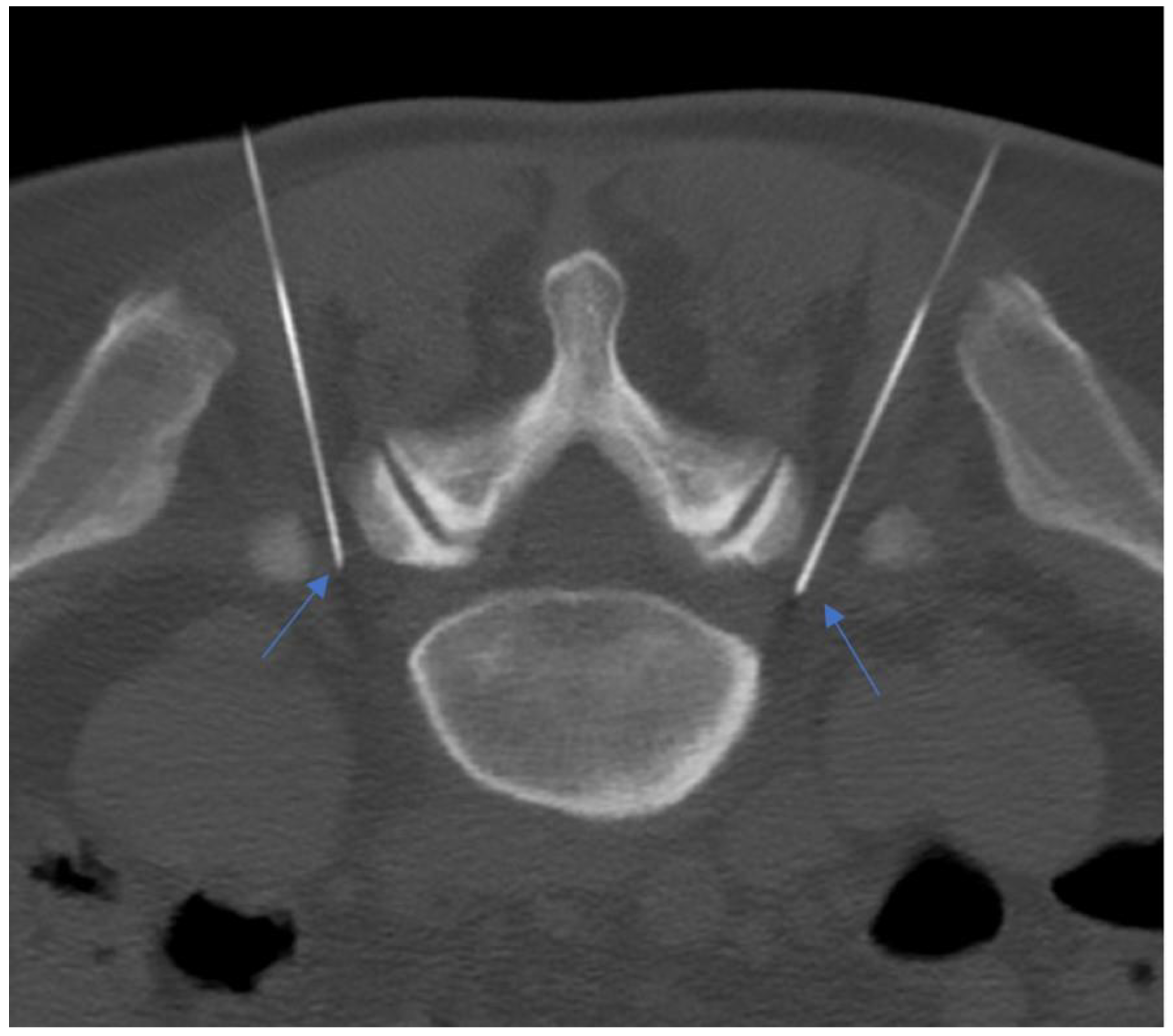 Diagnostics 14 01147 g012